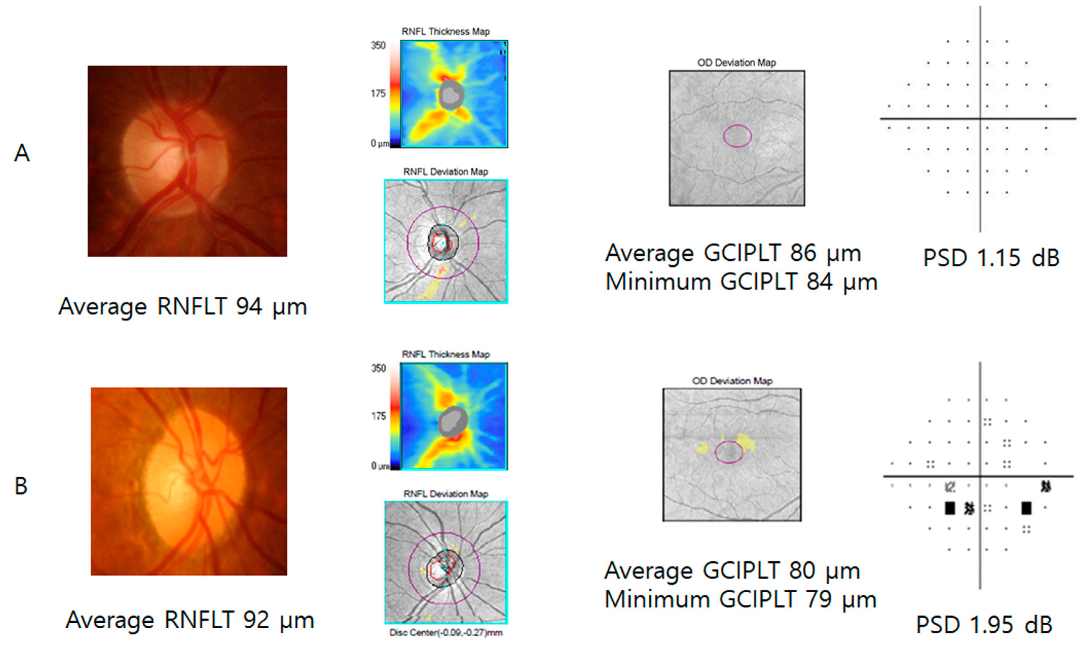 Jcm 09 01951 g003 Jcm 09 01951 g003