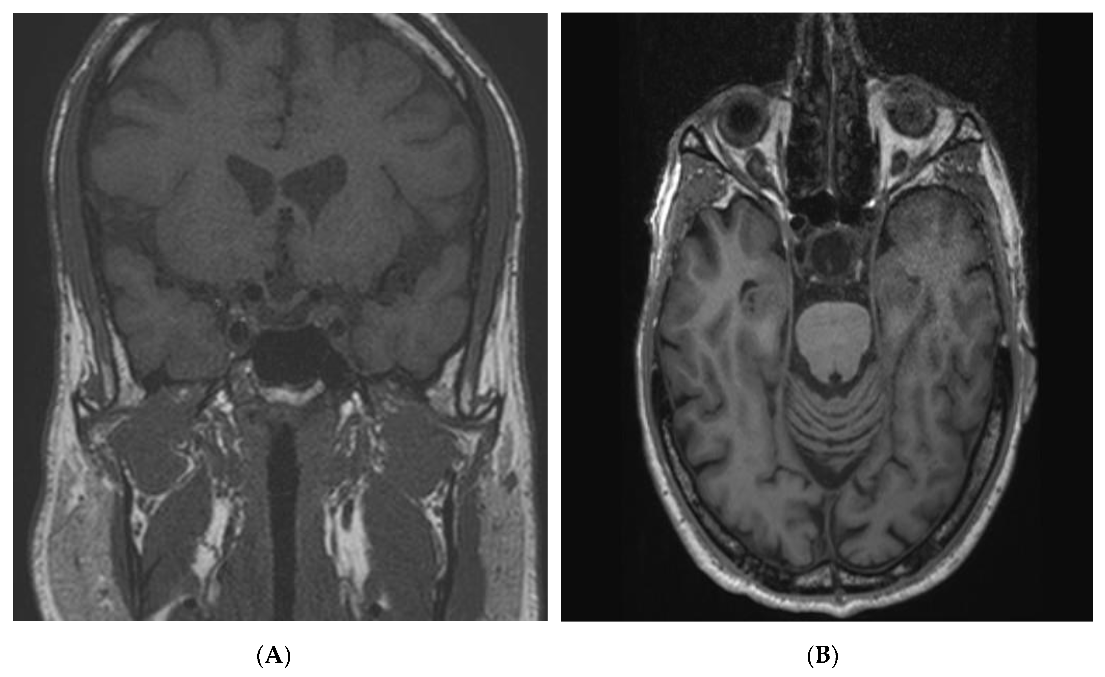 Jcm 09 02003 g001a Jcm 09 02003 g001a
