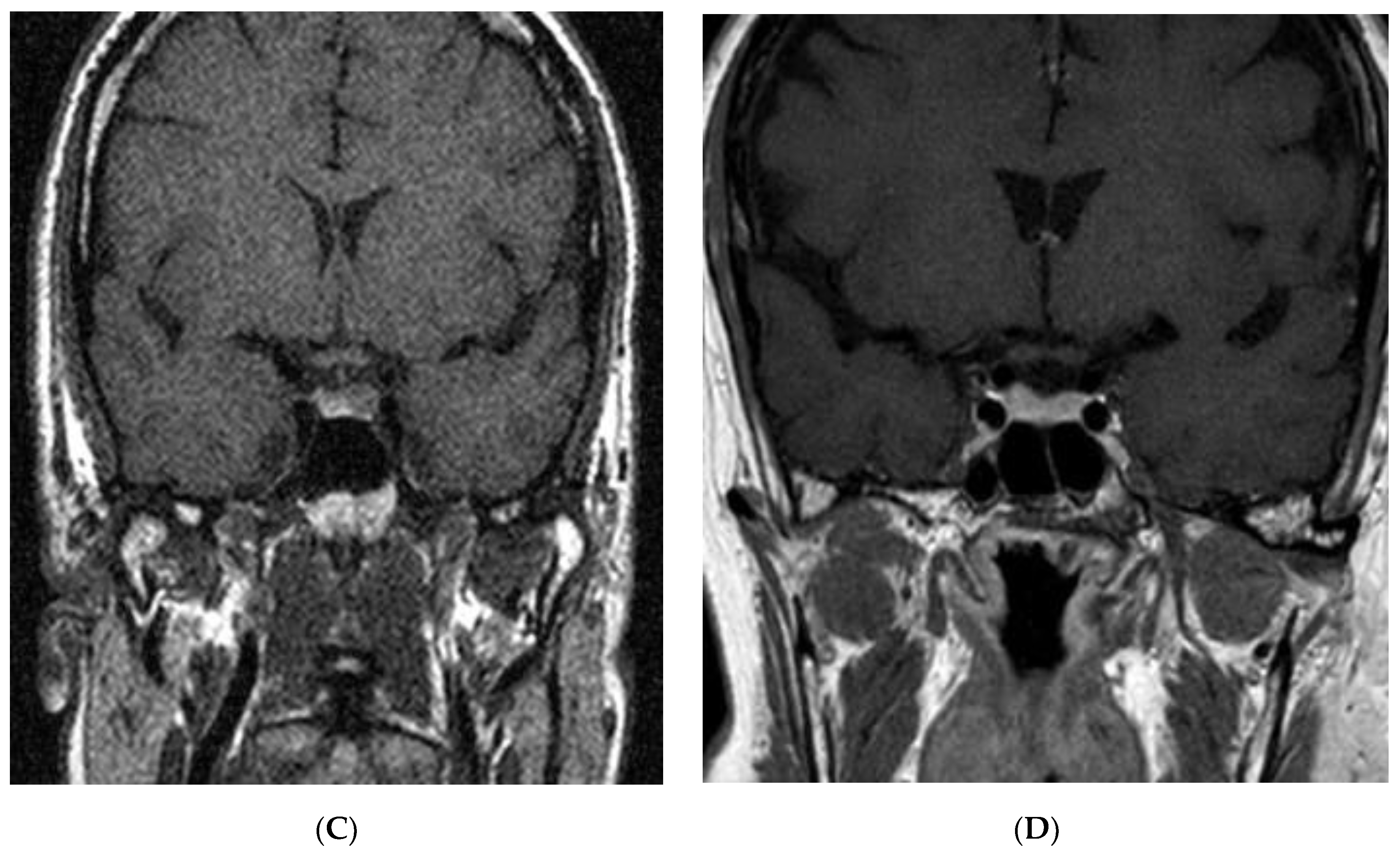 Jcm 09 02003 g001b Jcm 09 02003 g001b