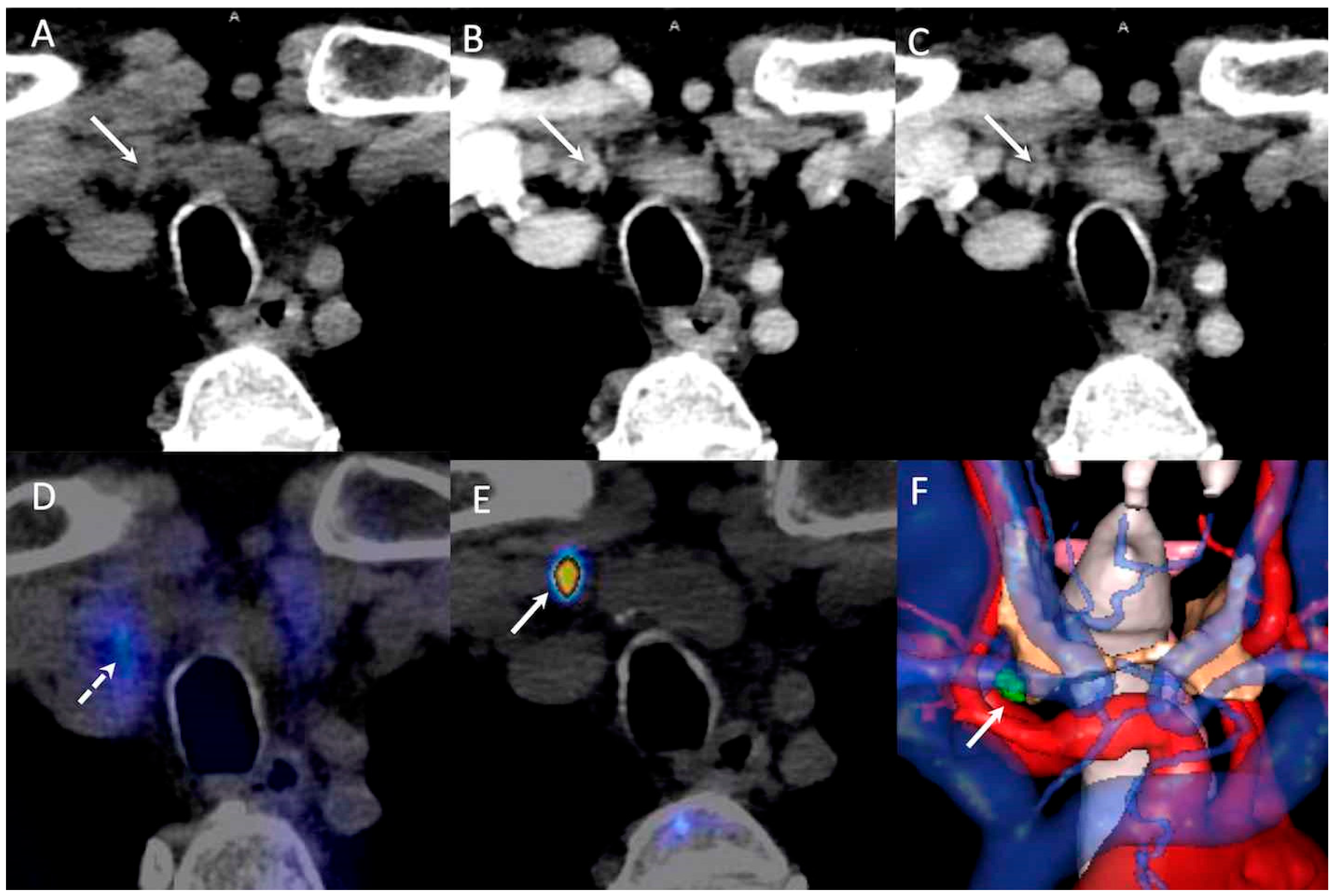 Jcm 09 02005 g002 Jcm 09 02005 g002