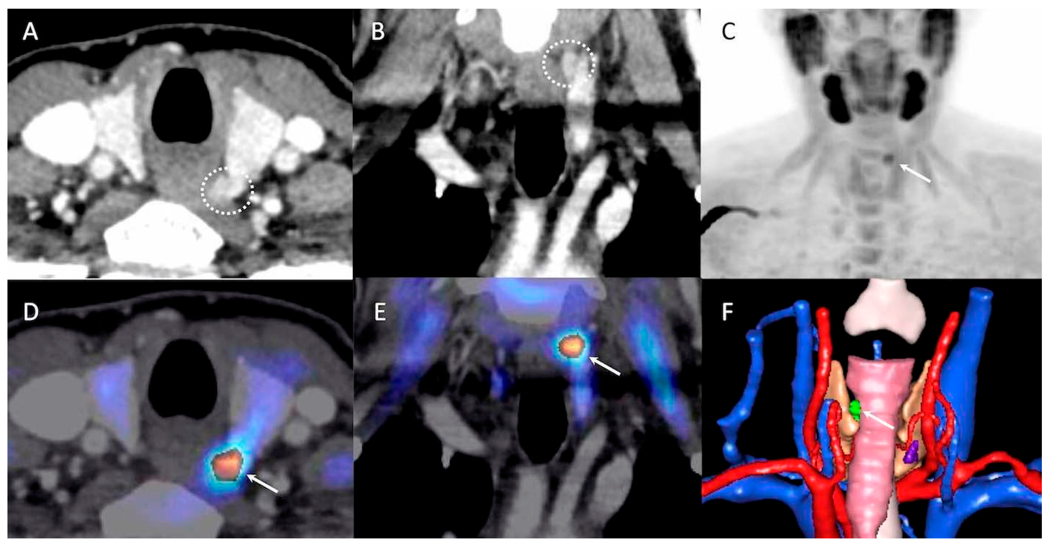 Jcm 09 02005 g003 Jcm 09 02005 g003