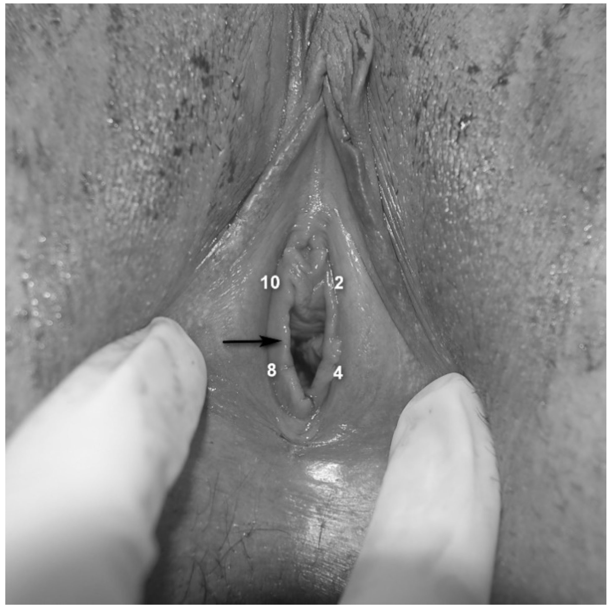 hymen close up 