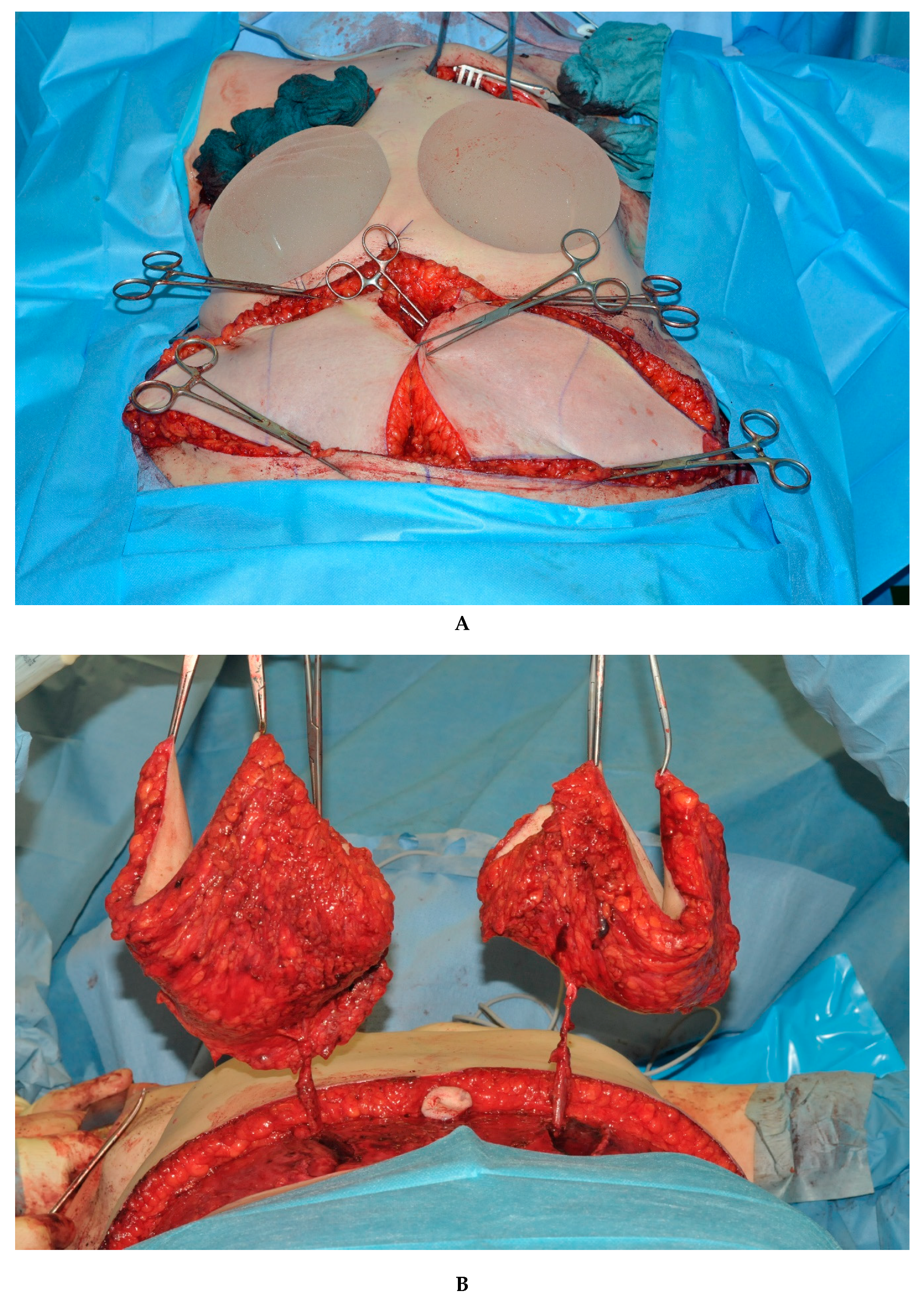 Jcm 09 02031 g002a Jcm 09 02031 g002a