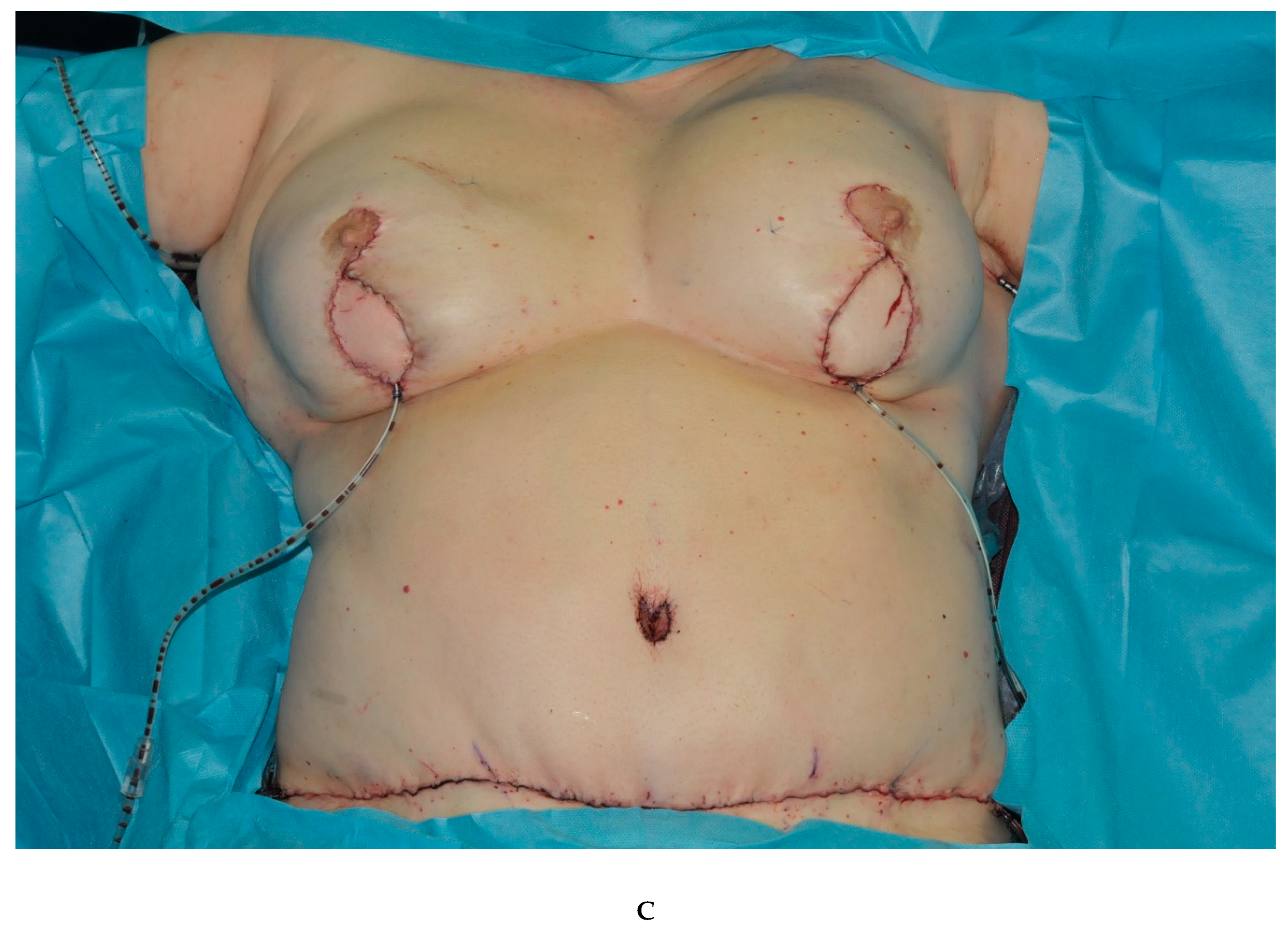 Jcm 09 02031 g002b Jcm 09 02031 g002b