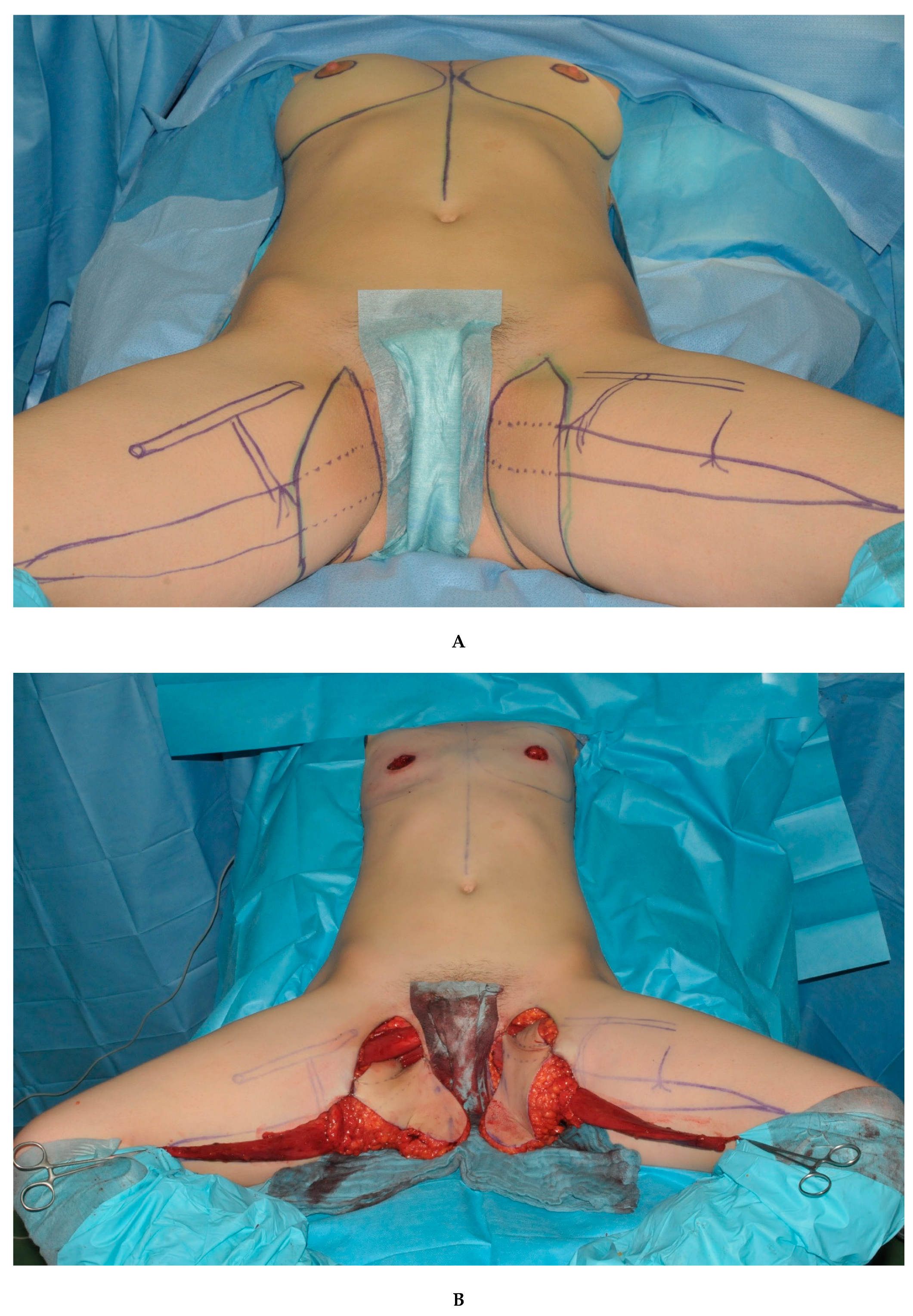 Jcm 09 02031 g003a Jcm 09 02031 g003a