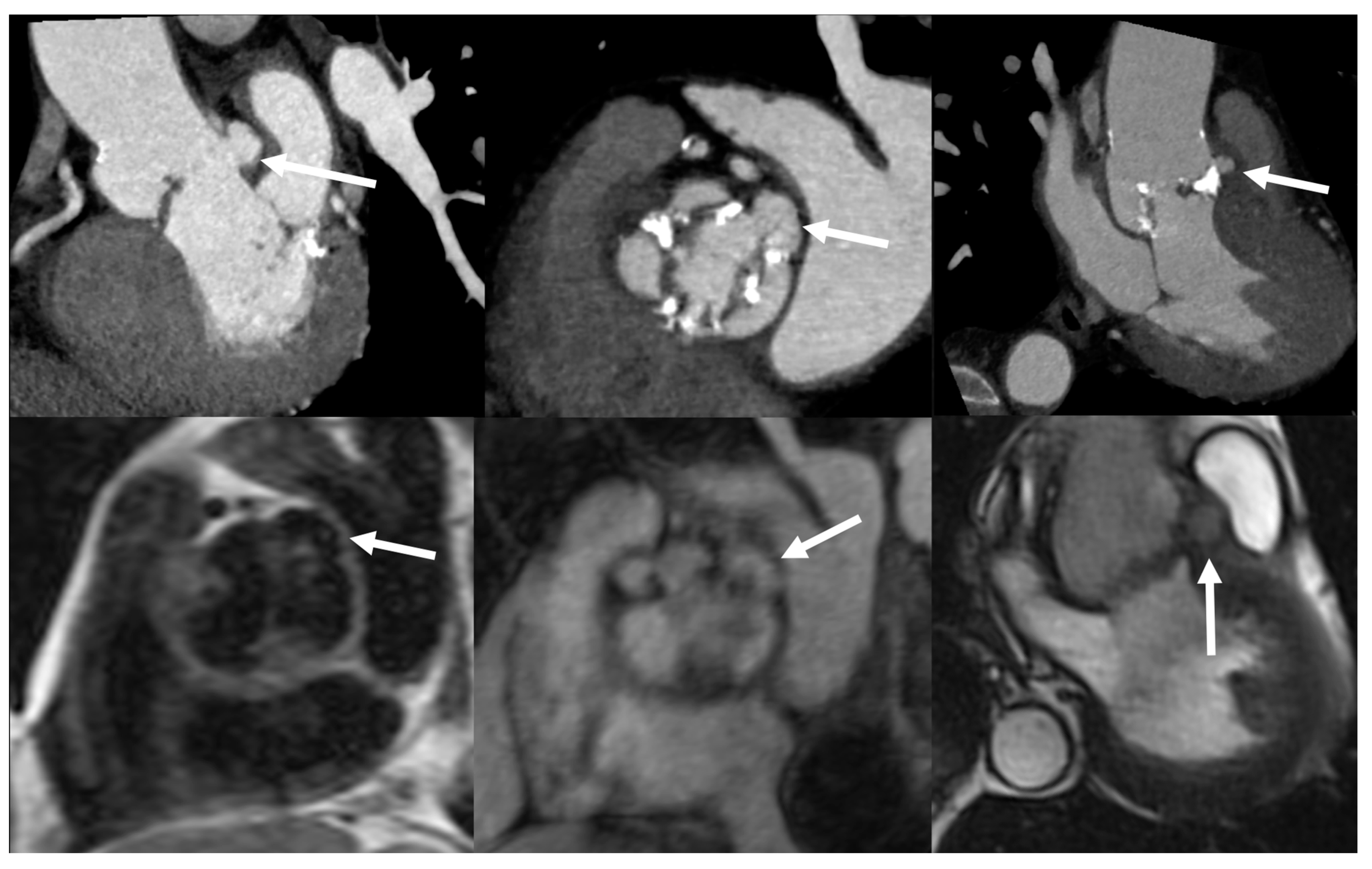 Jcm 09 02237 g004 Jcm 09 02237 g004