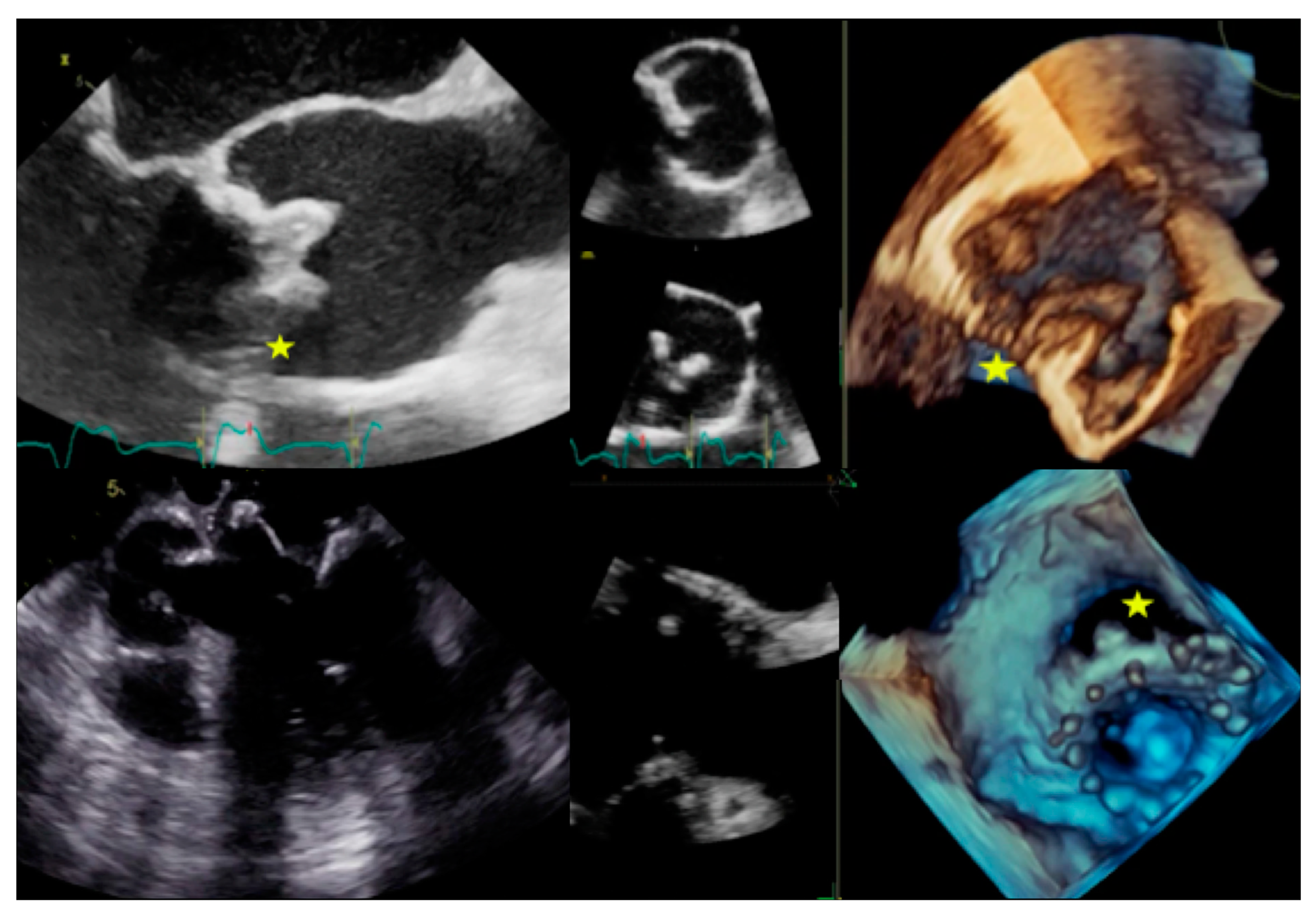 Jcm 09 02237 g005 Jcm 09 02237 g005