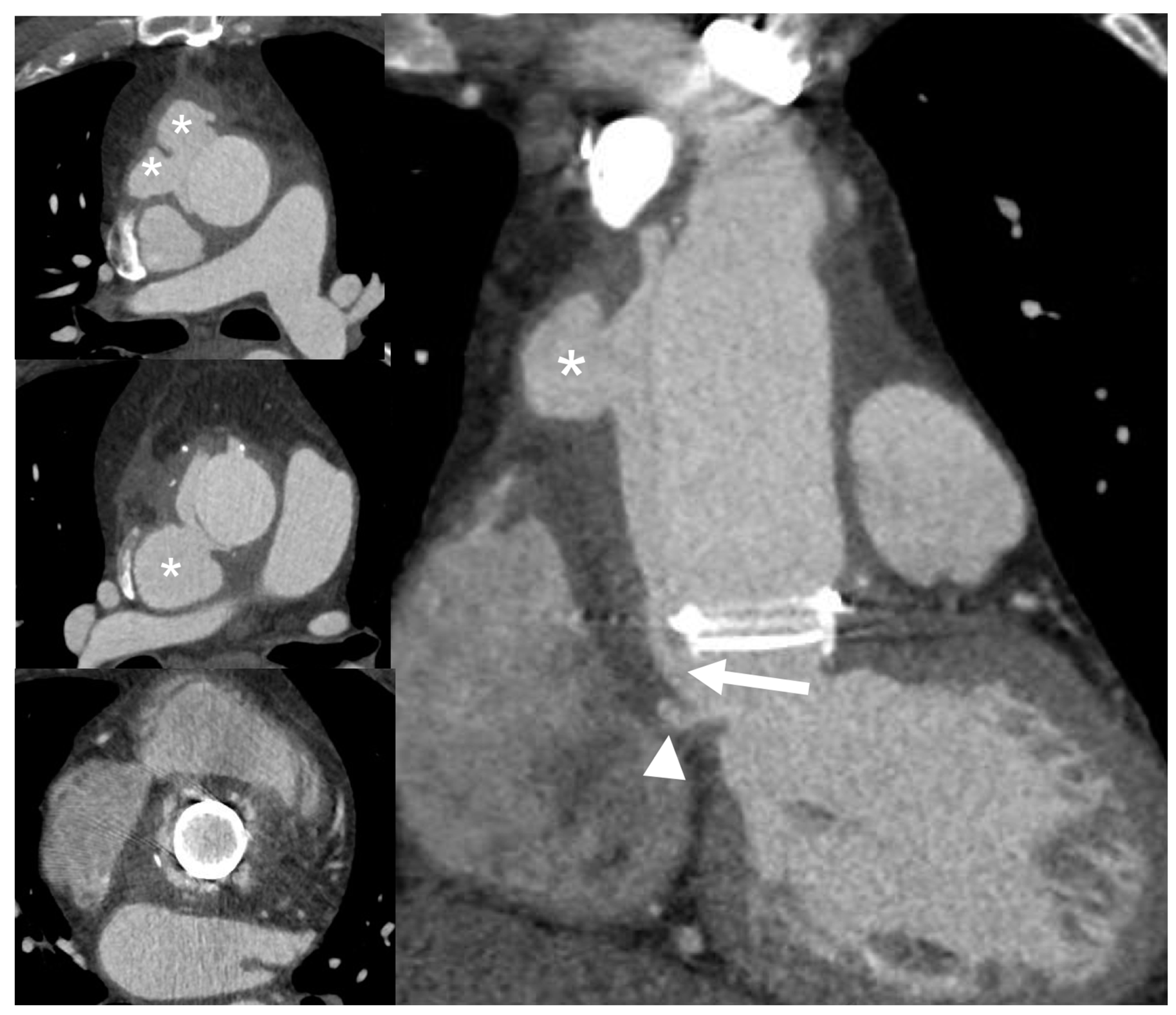 Jcm 09 02237 g006 Jcm 09 02237 g006