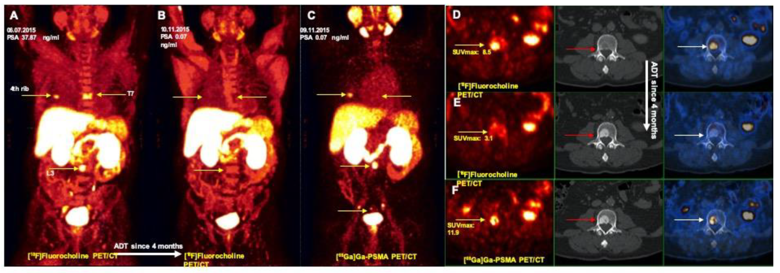 Jcm 09 02308 g004 Jcm 09 02308 g004