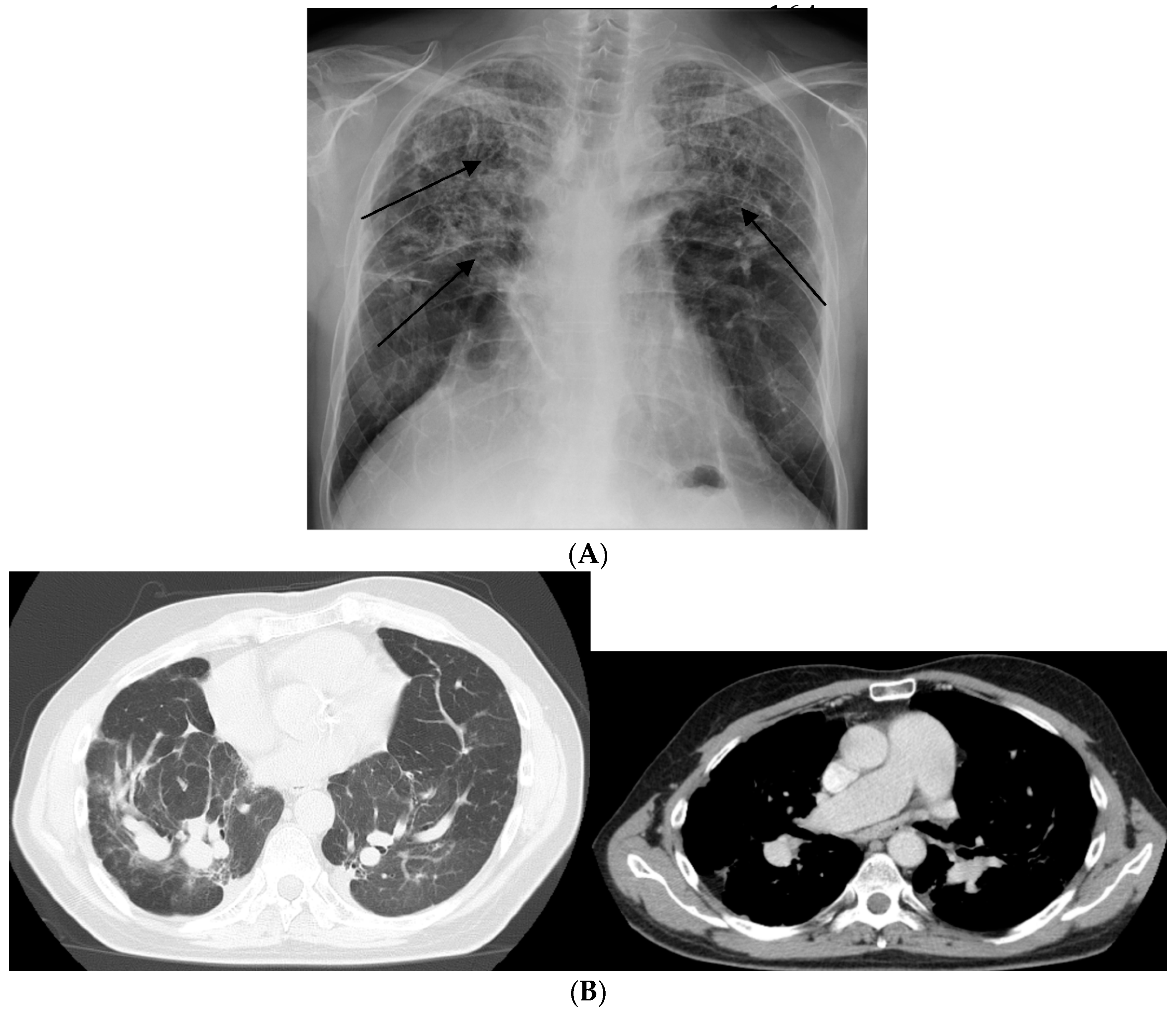 Jcm 09 02363 g003 Jcm 09 02363 g003