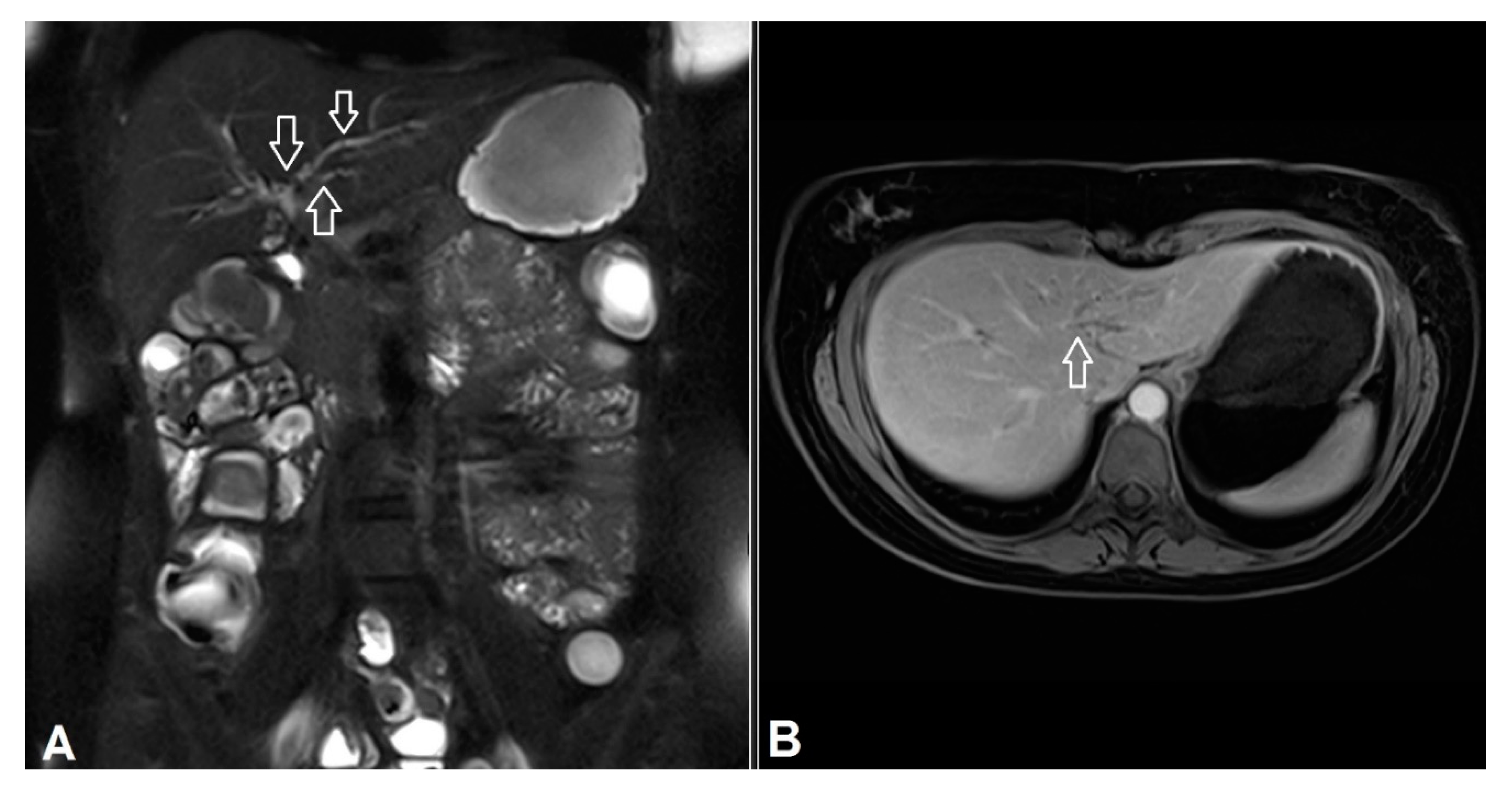 Jcm 09 02474 g004 Jcm 09 02474 g004