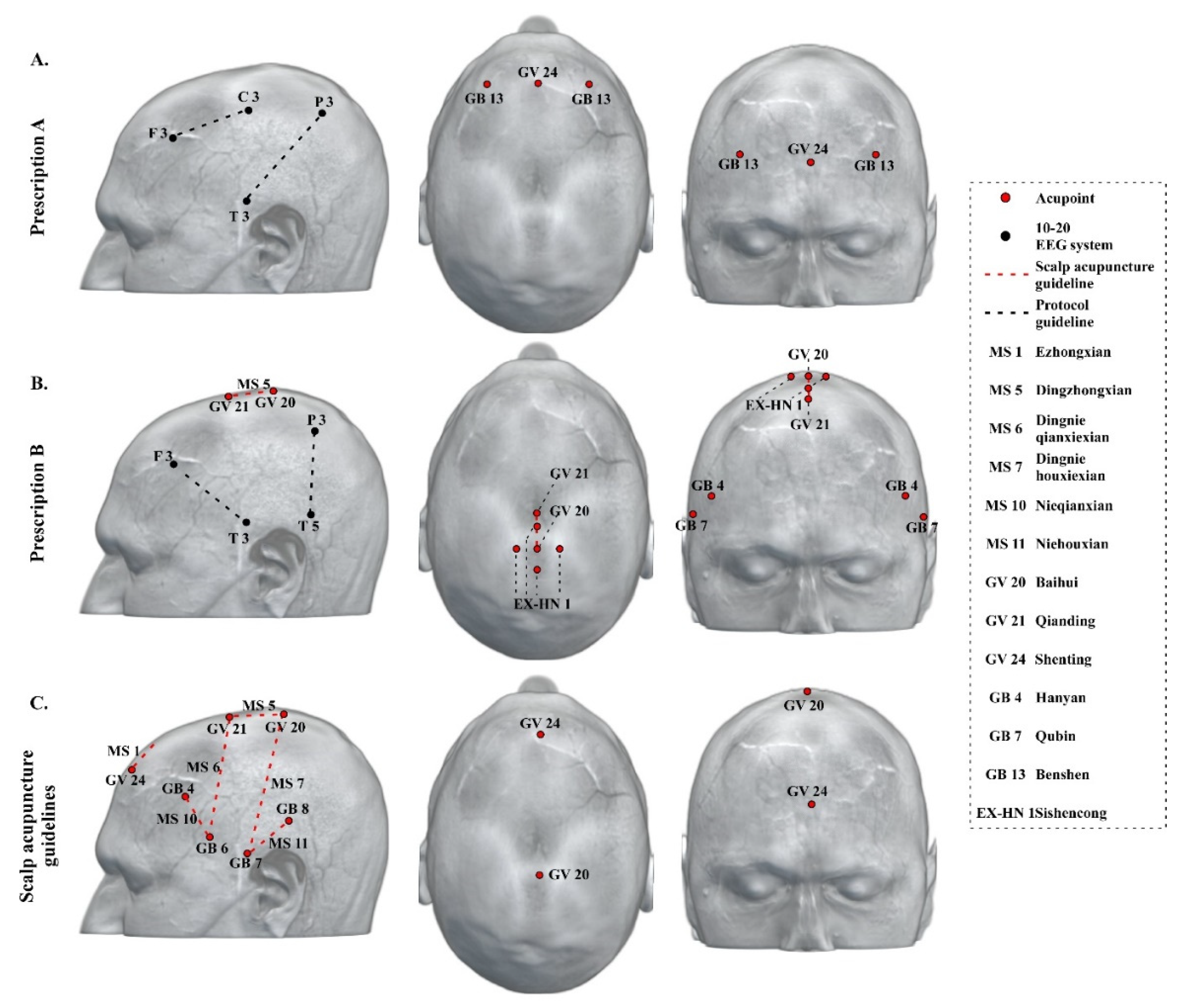 Jcm Free Full Text Neuroimaging Based Scalp Acupuncture Locations For Dementia Html