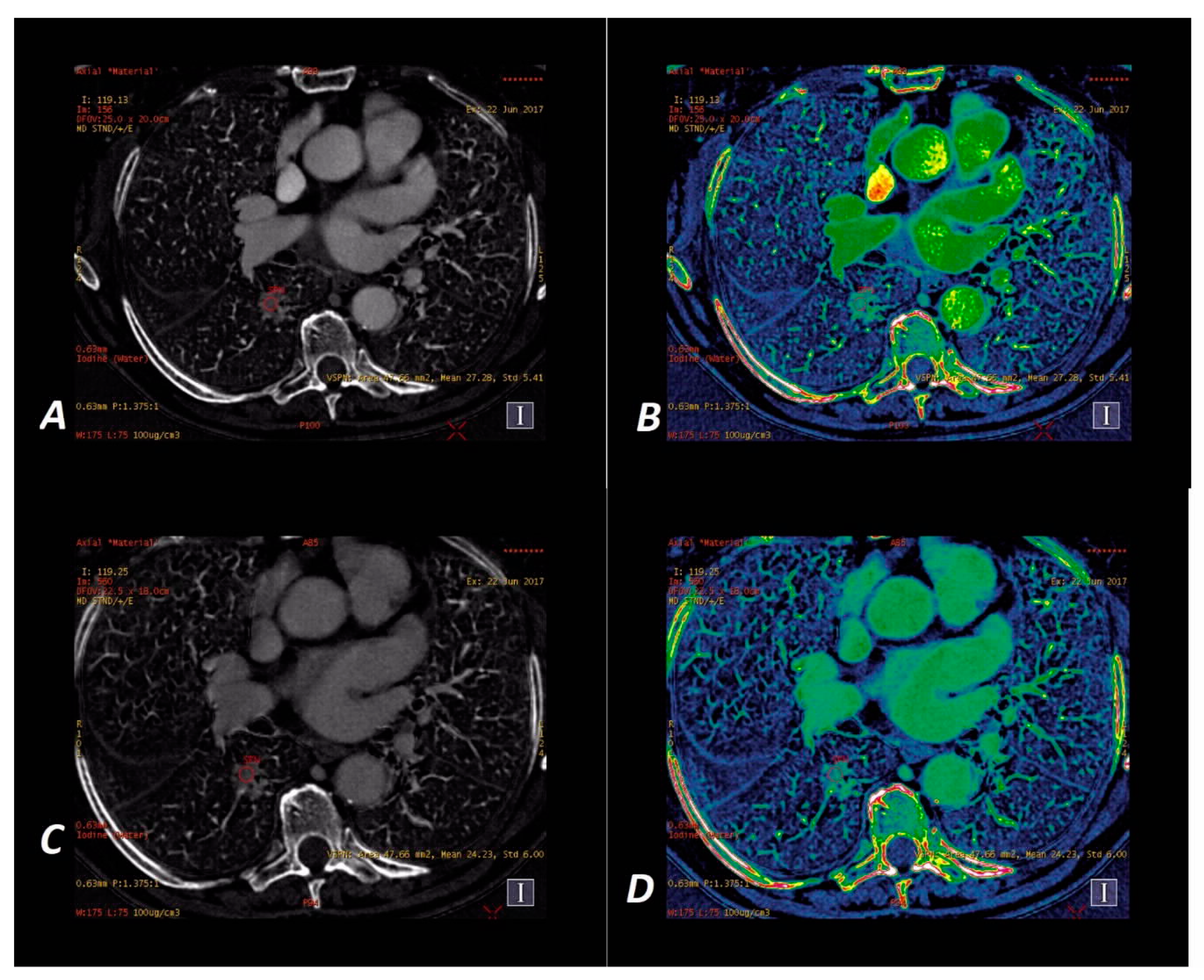 Jcm 09 02514 g004 Jcm 09 02514 g004