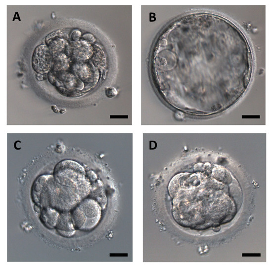 JCM Free FullText Metabolic Activity of Human Embryos after Thawing Differs in Atmosphere