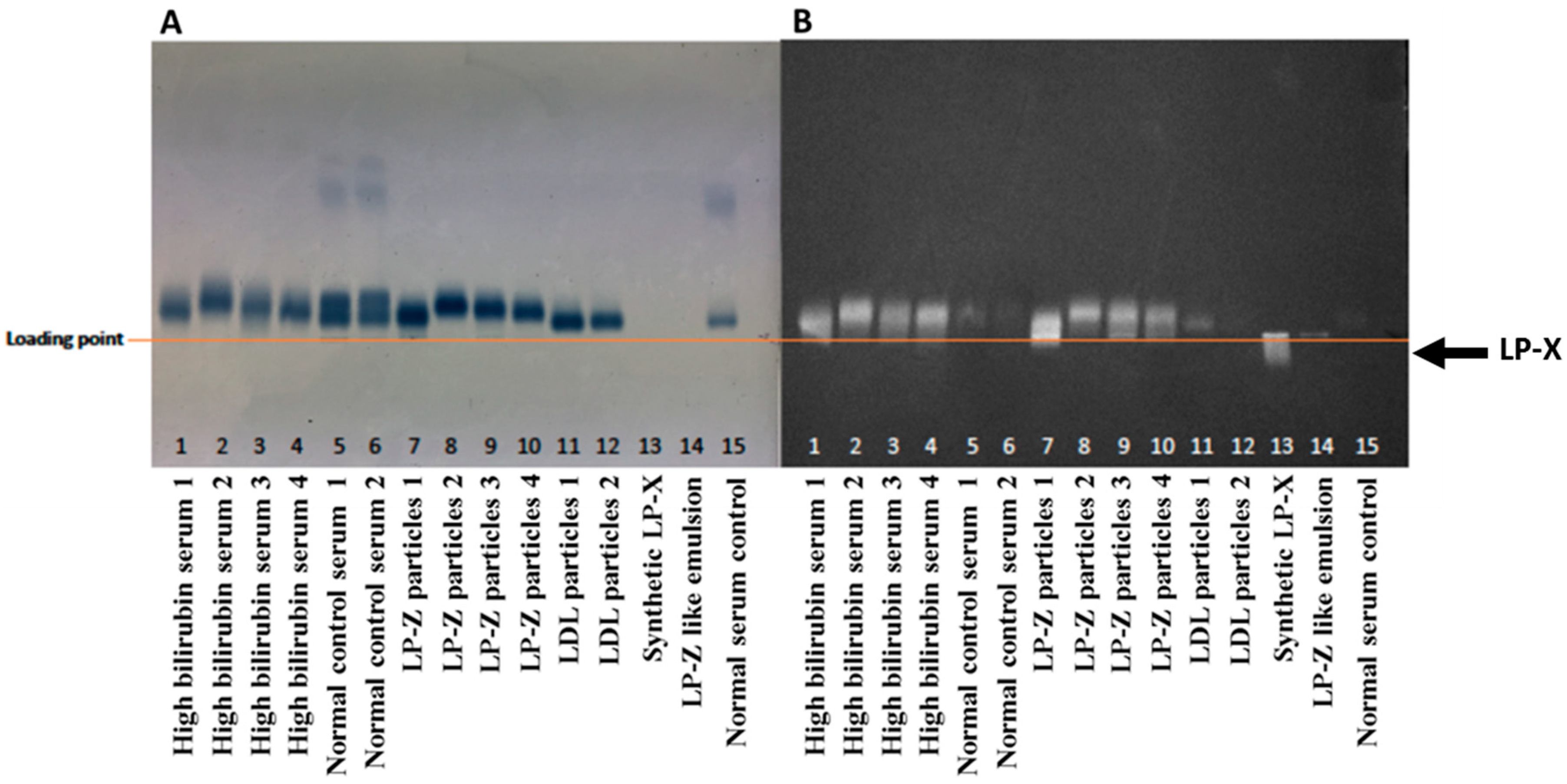 JCM Free FullText Characterization of LPZ Lipoprotein Particles and Quantification in