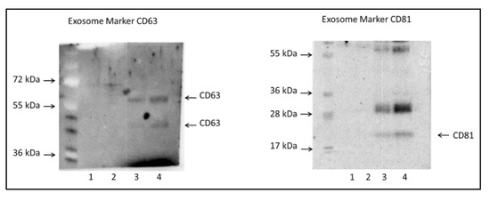 Jcm Free Full Text Proteomic Profiles Of Exosomes Of Septic Patients Presenting To The Emergency Department Compared To Healthy Controls Html Jcm Free Full Text Proteomic Profiles Of Exosomes Of Septic Patients Presenting To The Emergency Department Compared To Healthy Controls Html