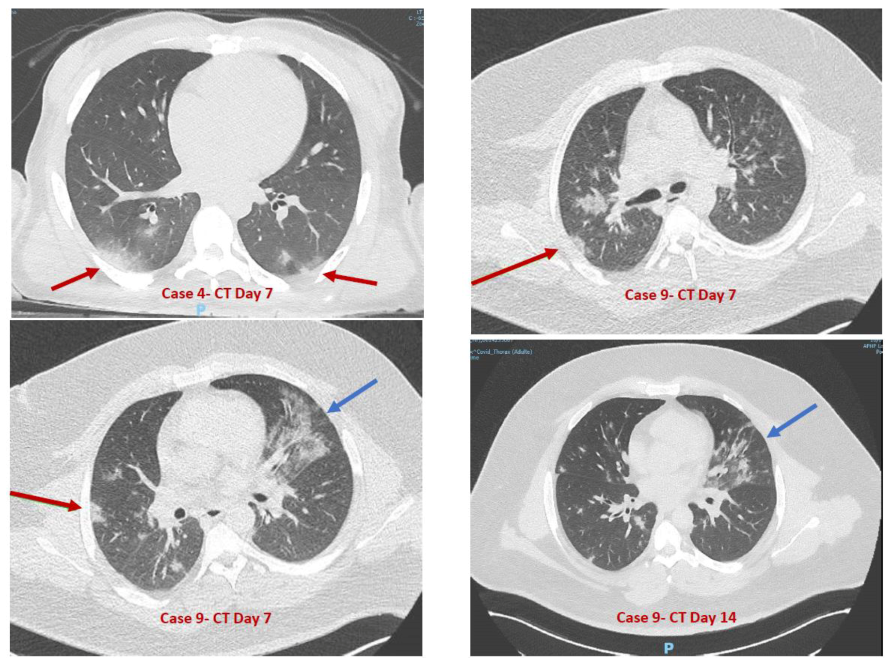 Jcm 09 02937 g001 Jcm 09 02937 g001