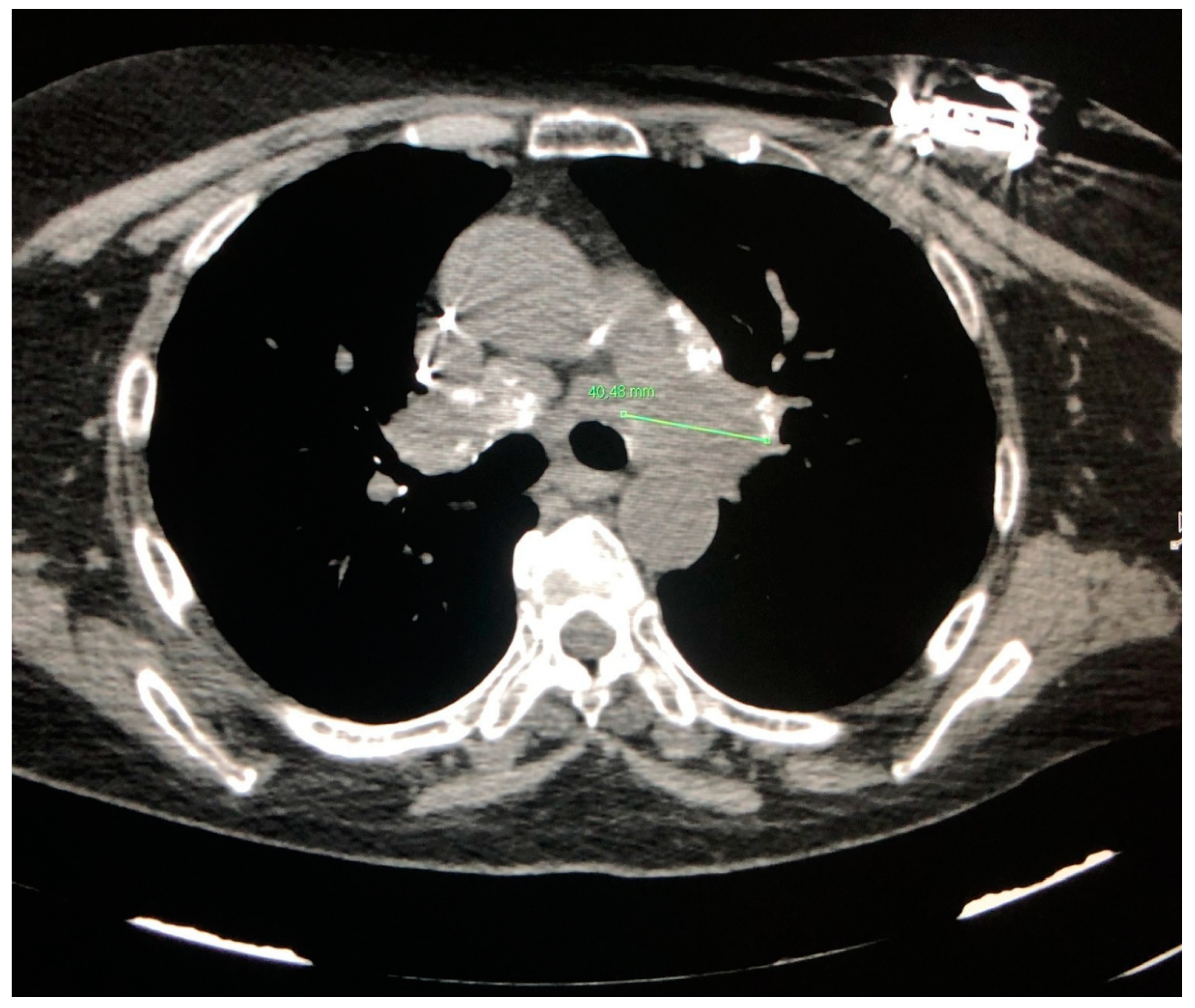 Jcm 09 03028 g003 Jcm 09 03028 g003