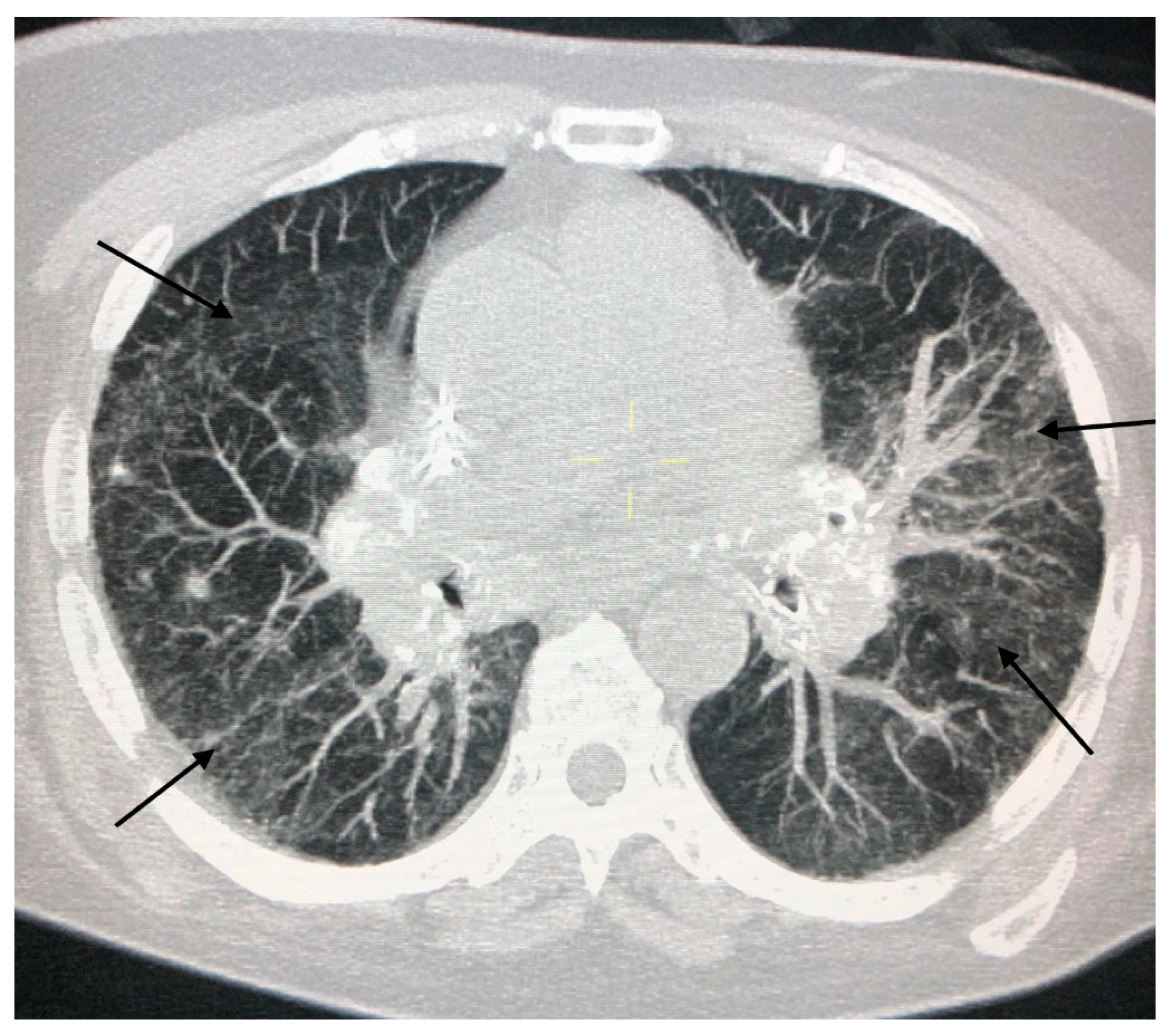 Jcm 09 03028 g004 Jcm 09 03028 g004