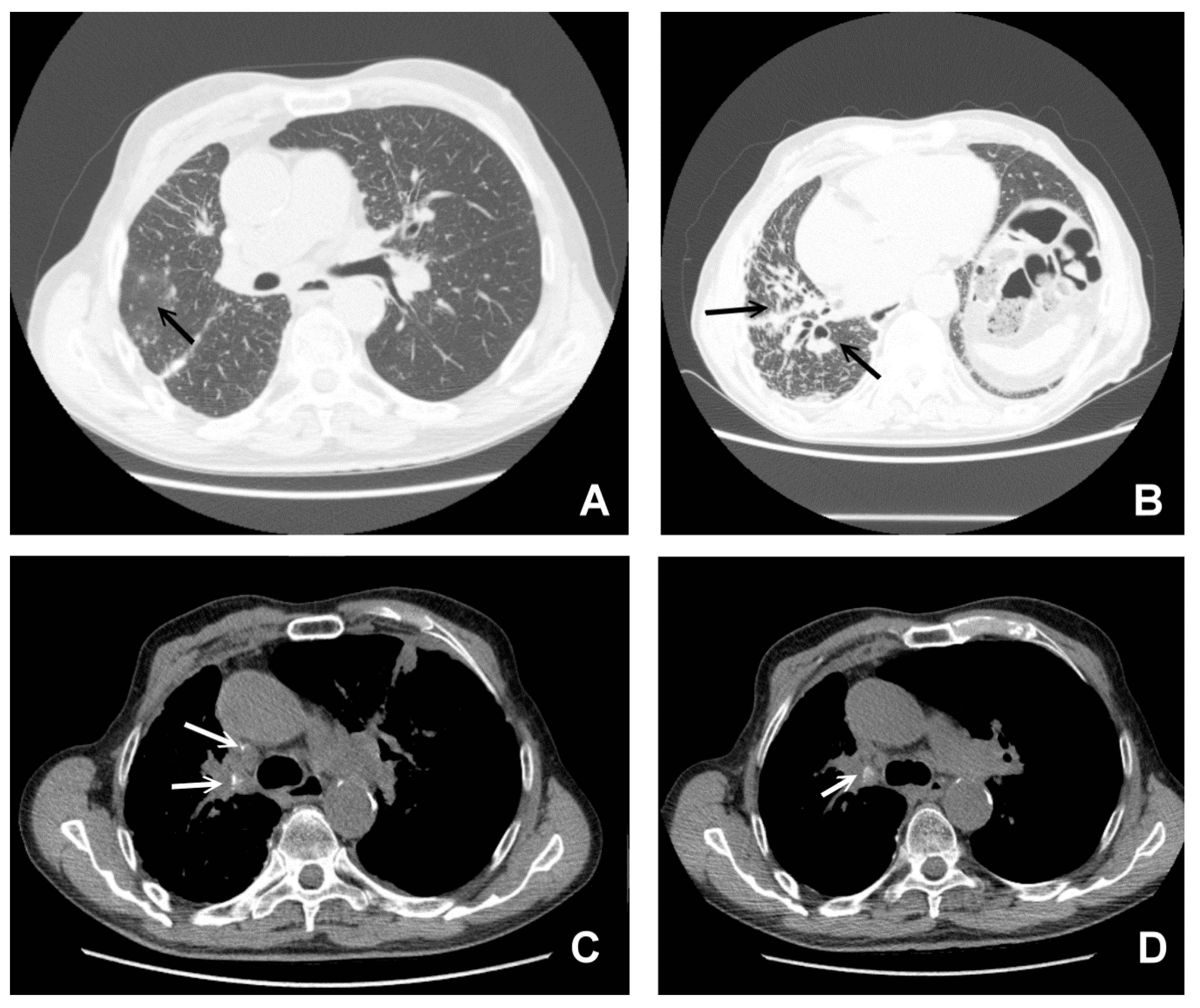 Jcm 09 03028 g005 Jcm 09 03028 g005