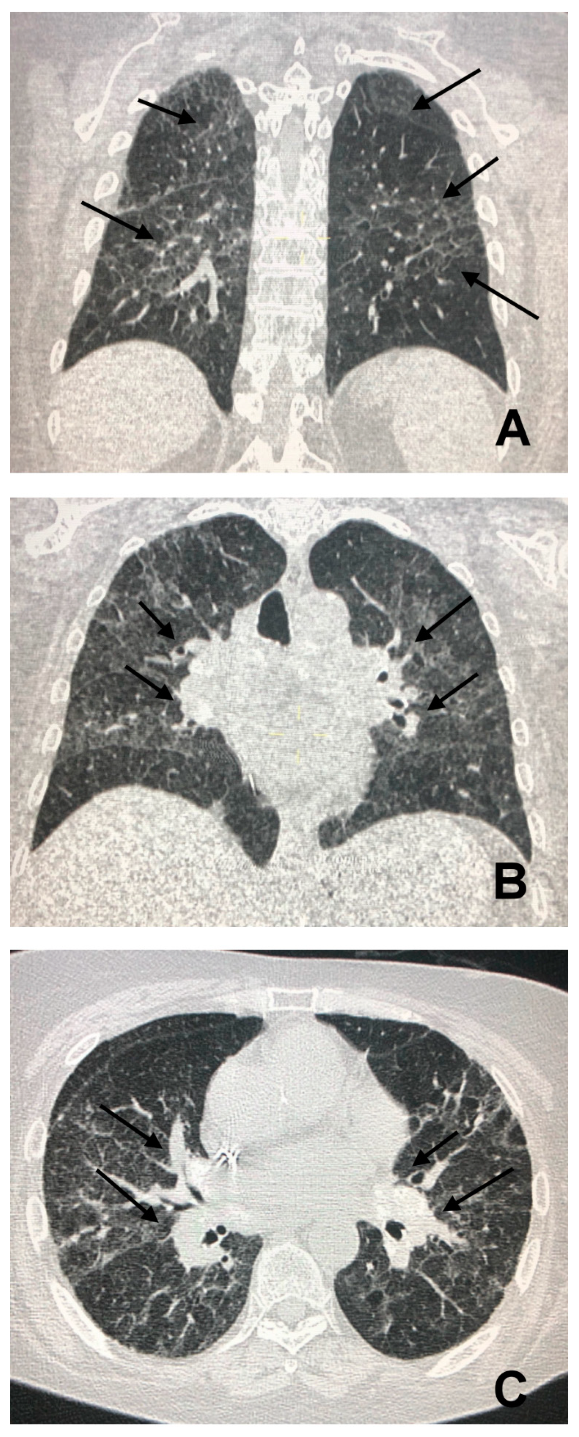 Jcm 09 03028 g006 Jcm 09 03028 g006