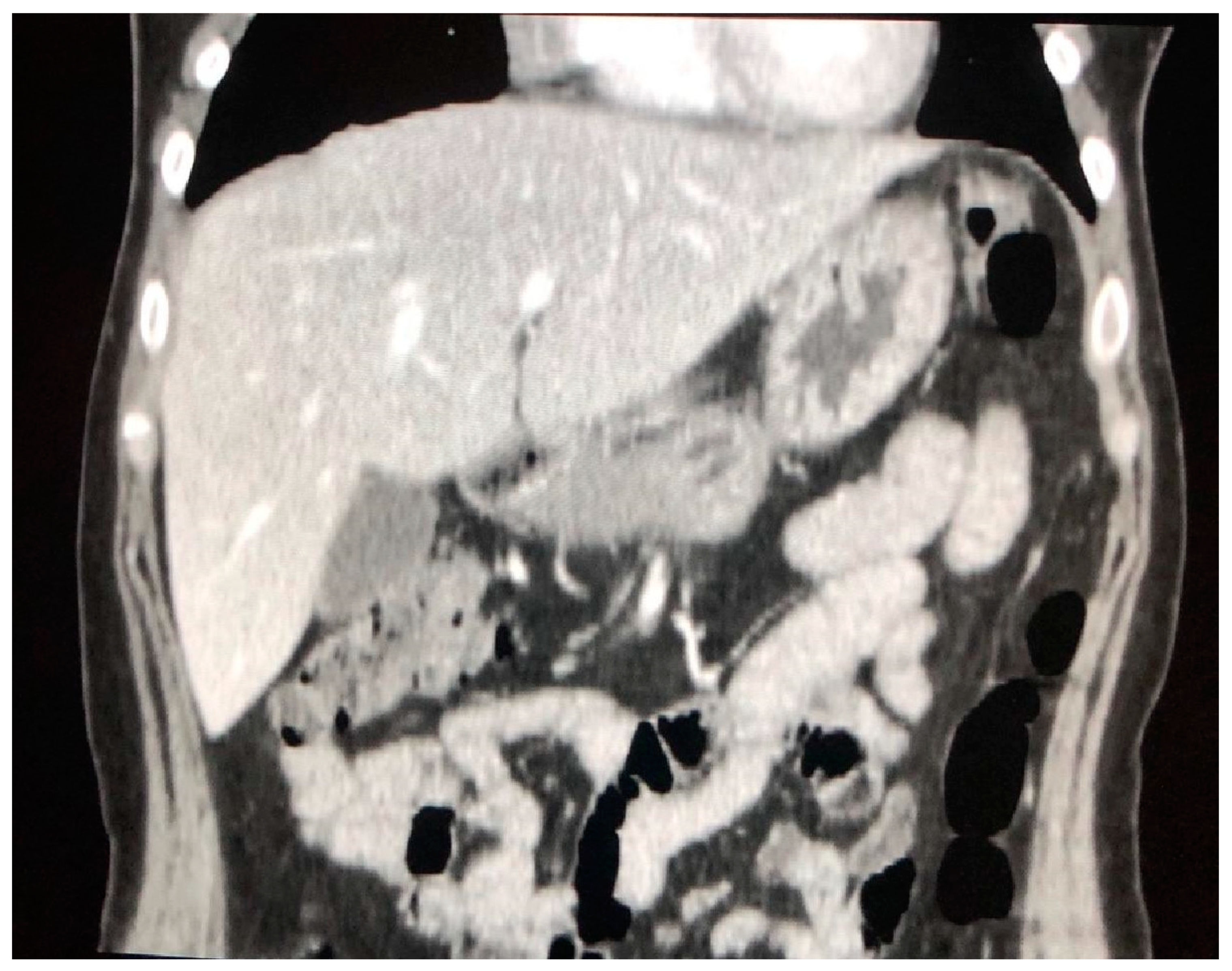 Jcm 09 03028 g007 Jcm 09 03028 g007