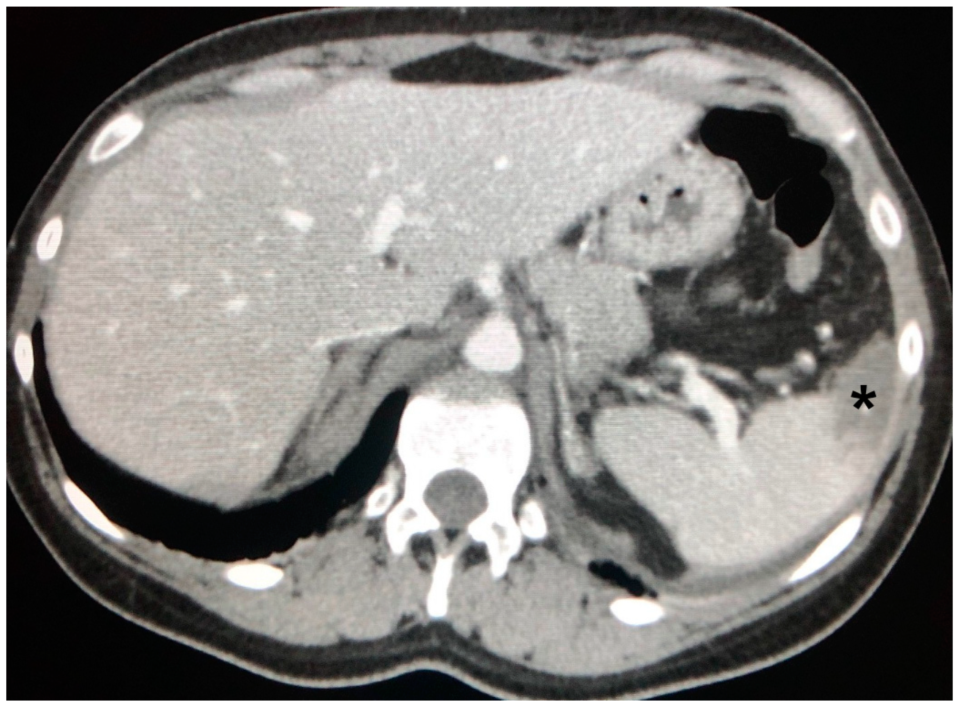 Jcm 09 03028 g008 Jcm 09 03028 g008