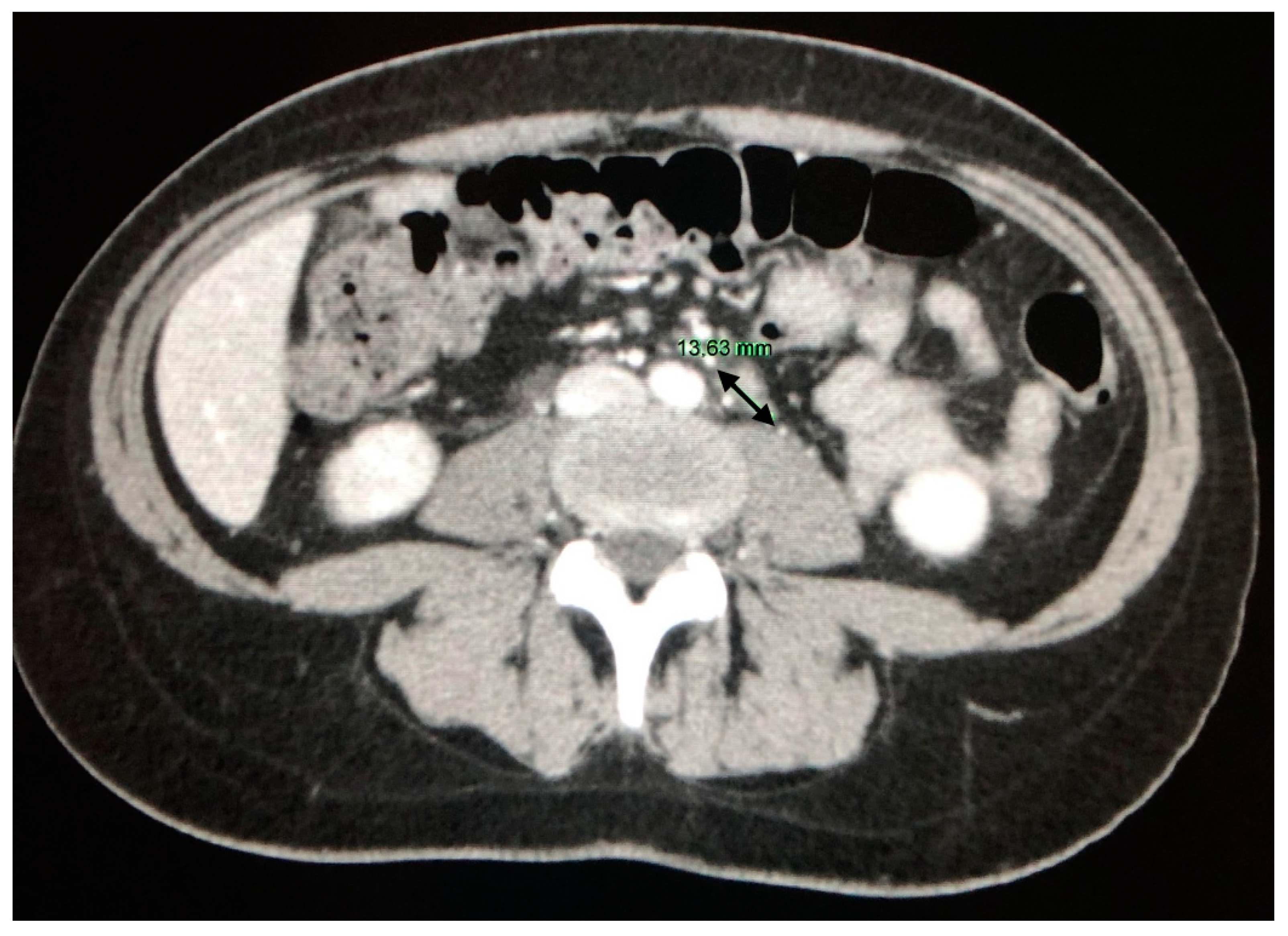 Jcm 09 03028 g009 Jcm 09 03028 g009