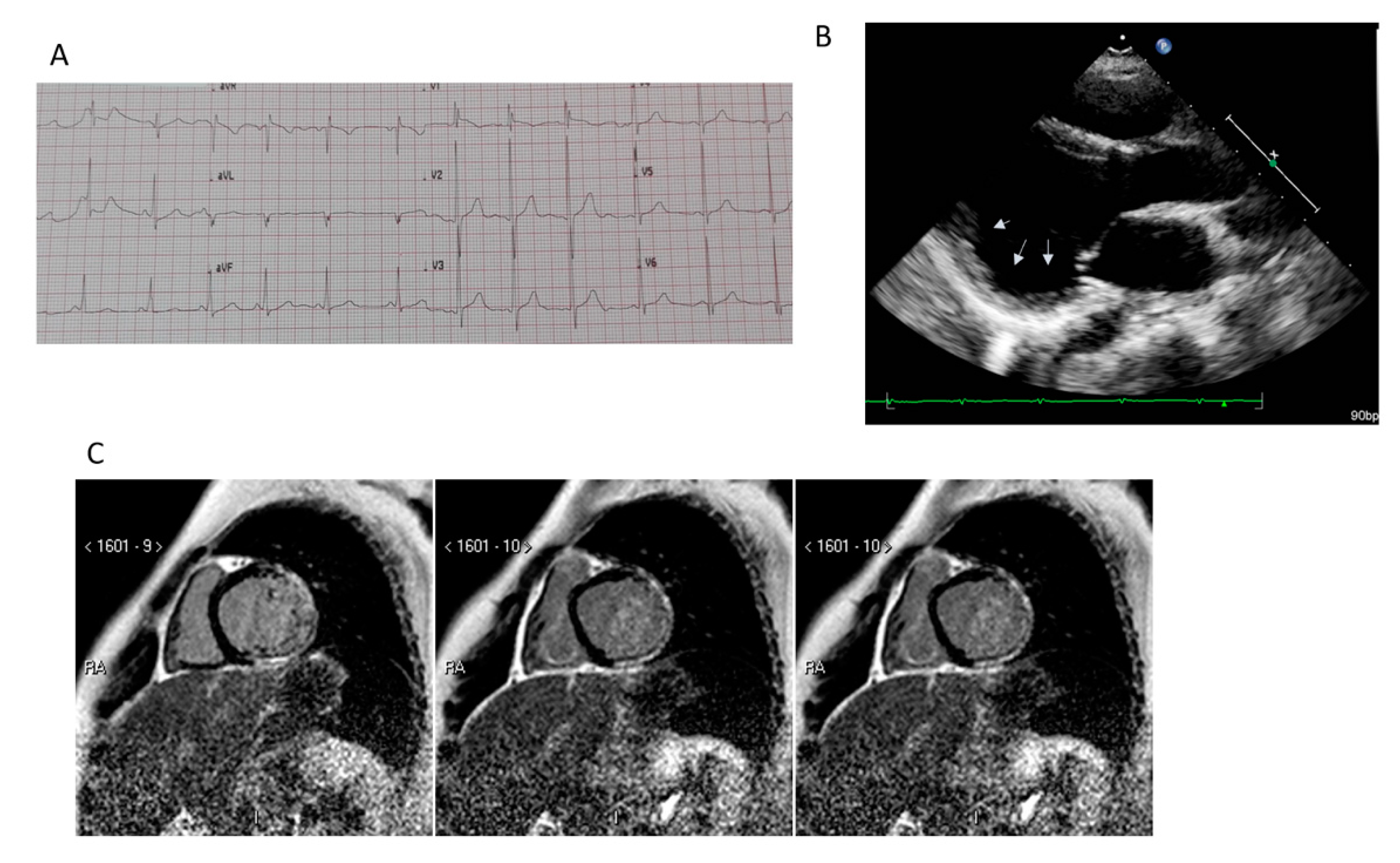 Jcm 09 03186 g001 Jcm 09 03186 g001