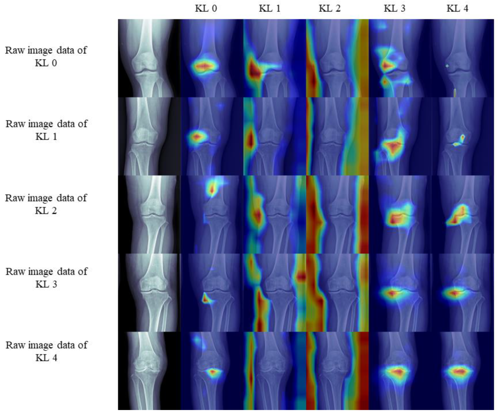 Jcm 09 03341 g005 Jcm 09 03341 g005