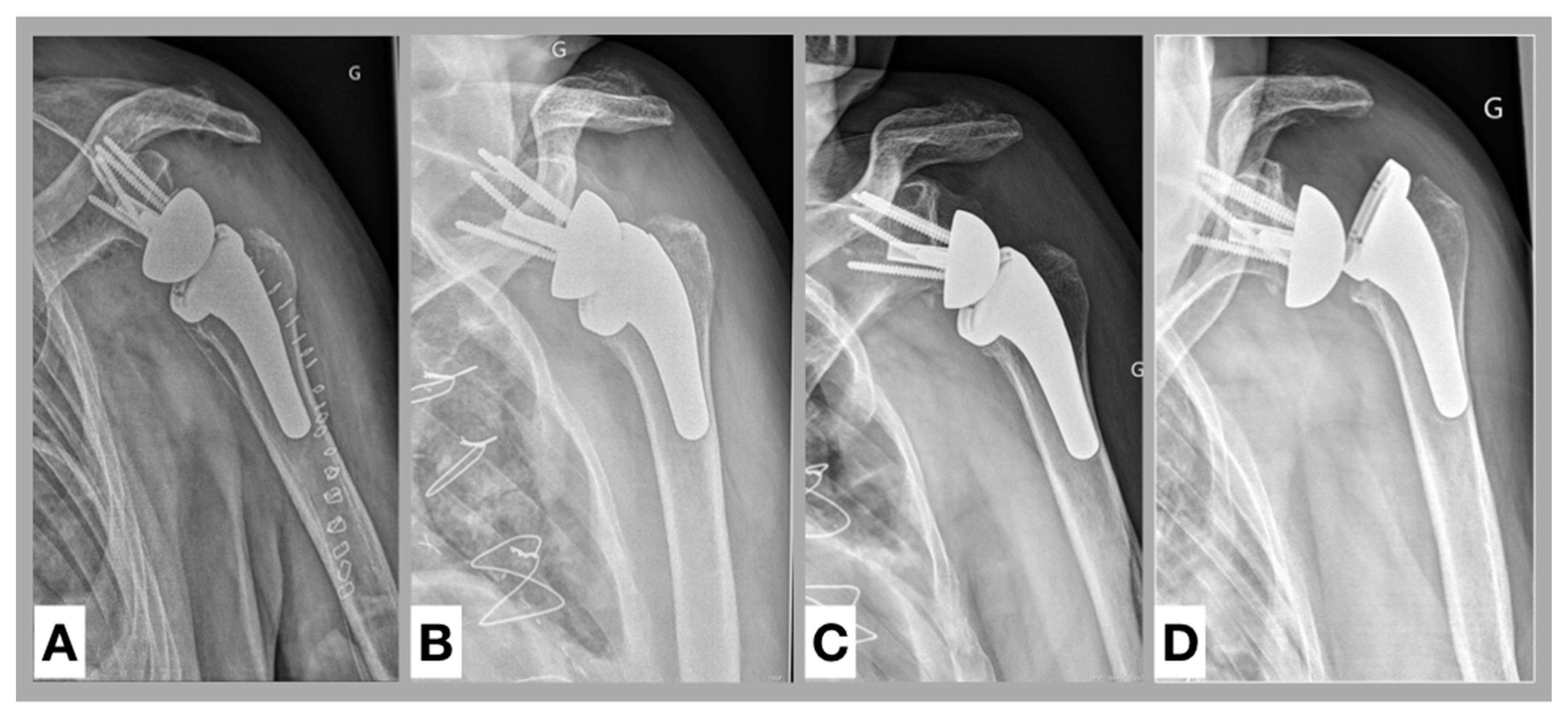 Jcm 09 03362 g004 Jcm 09 03362 g004