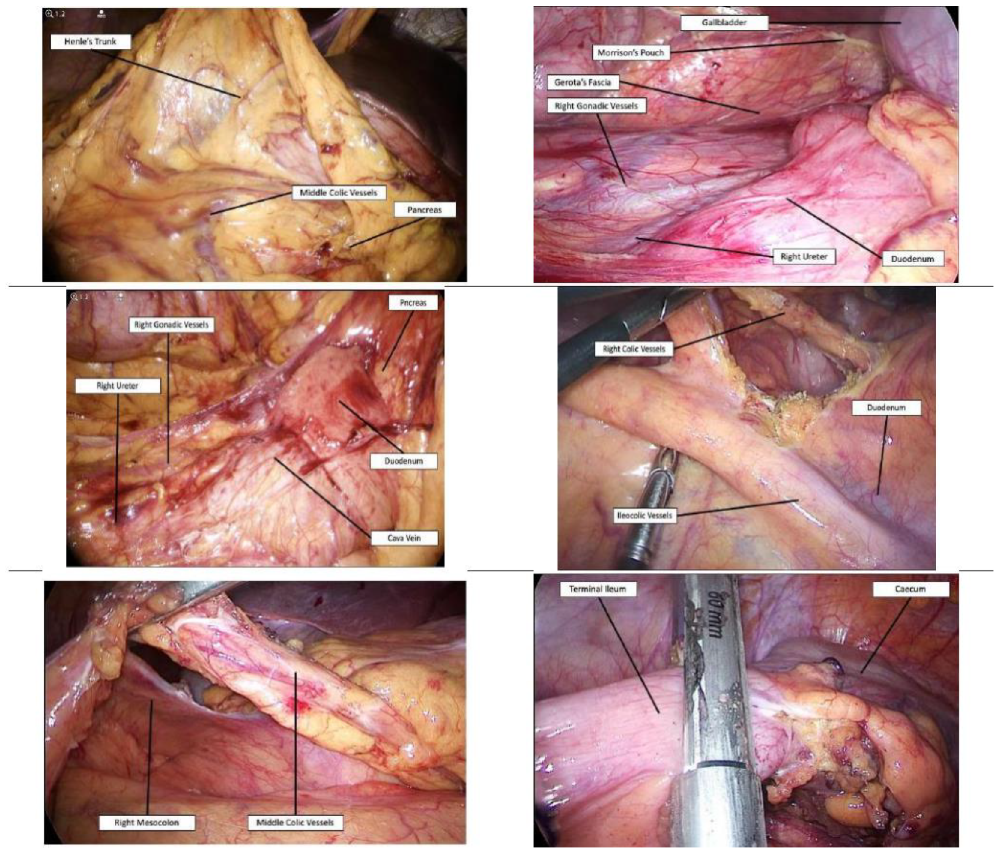Jcm 09 03382 g002 Jcm 09 03382 g002