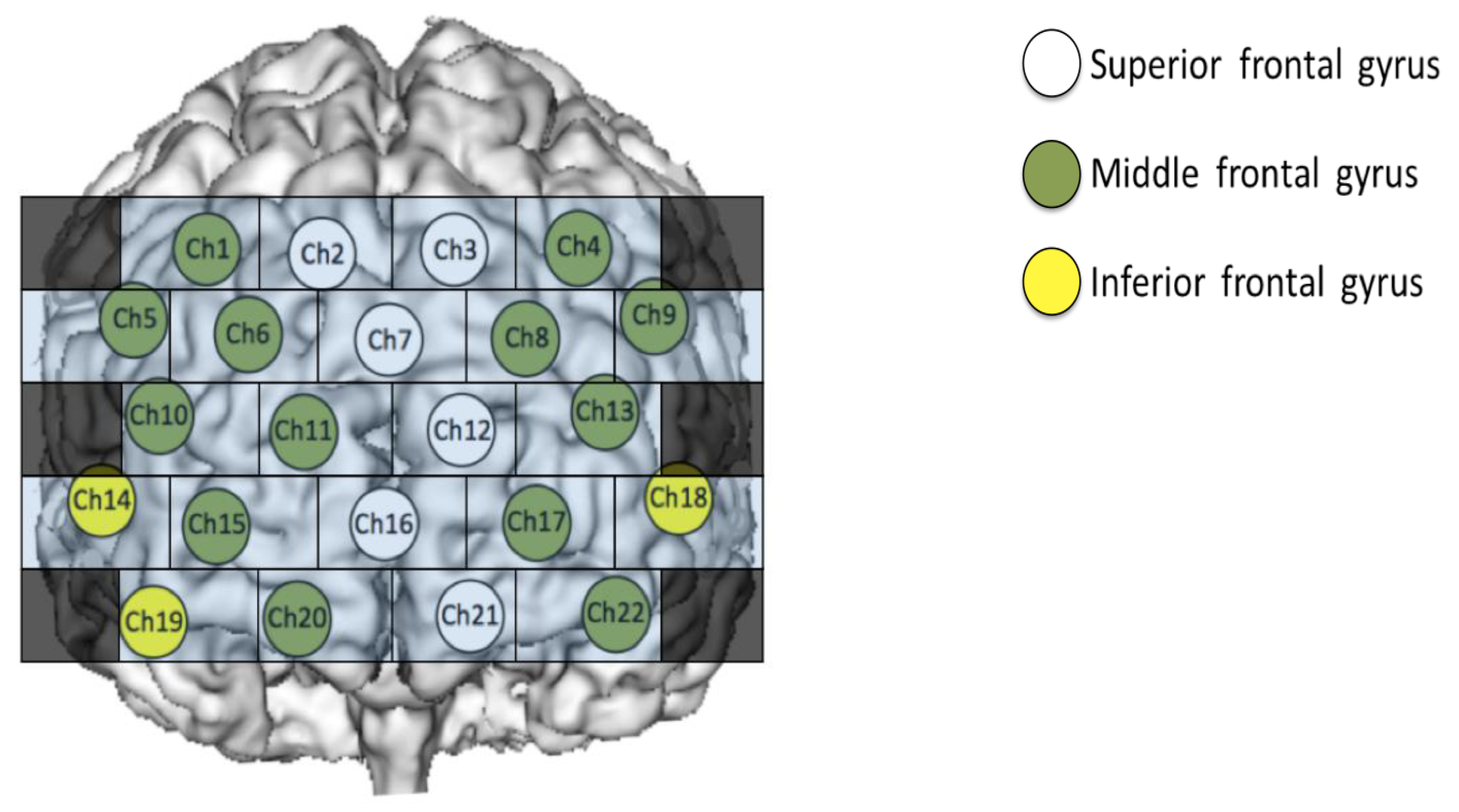 Jcm 09 03475 g003 Jcm 09 03475 g003