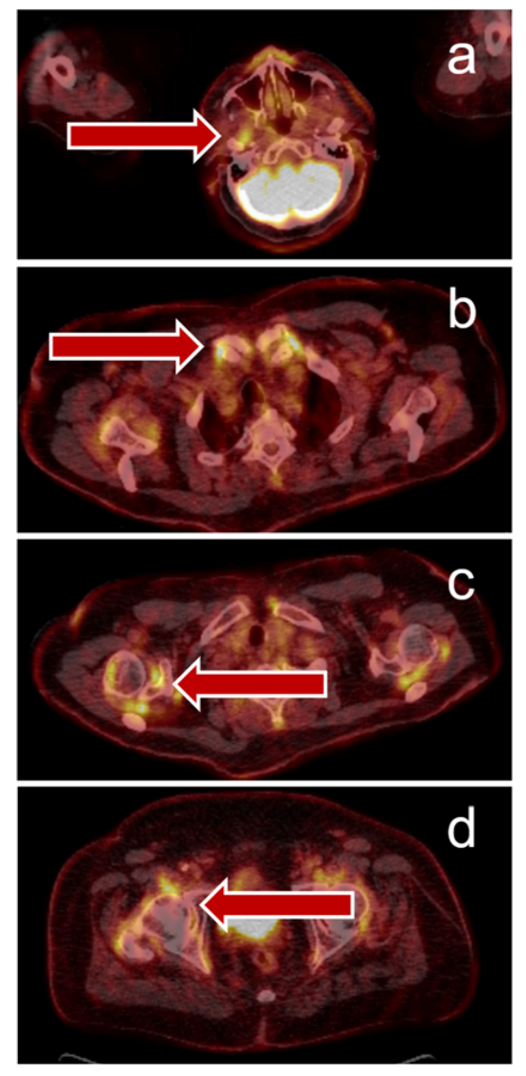 Jcm 09 03483 g003 Jcm 09 03483 g003
