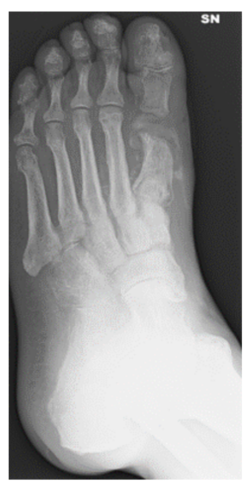 Multidisciplinary Approach for the Management and Treatment of Diabetic ...