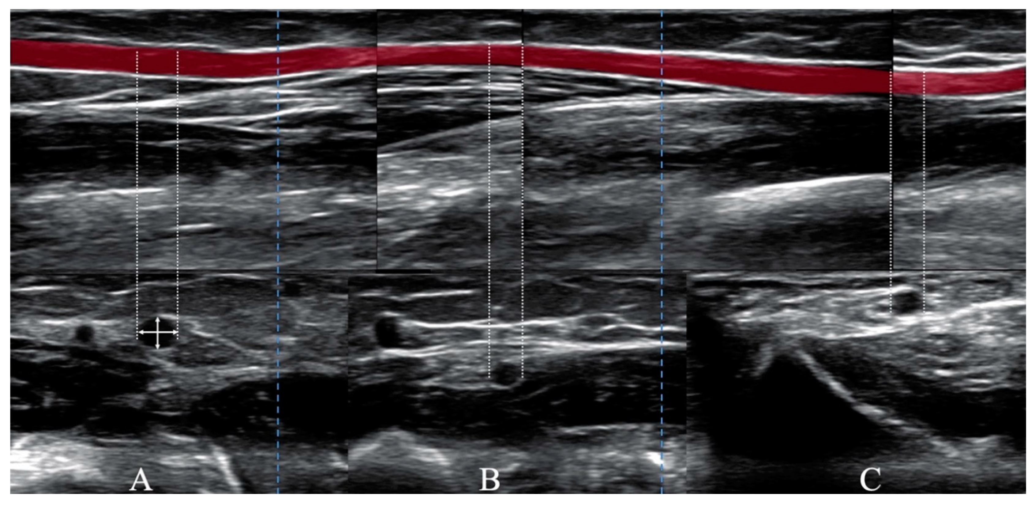 Jcm 09 03607 g001 Jcm 09 03607 g001