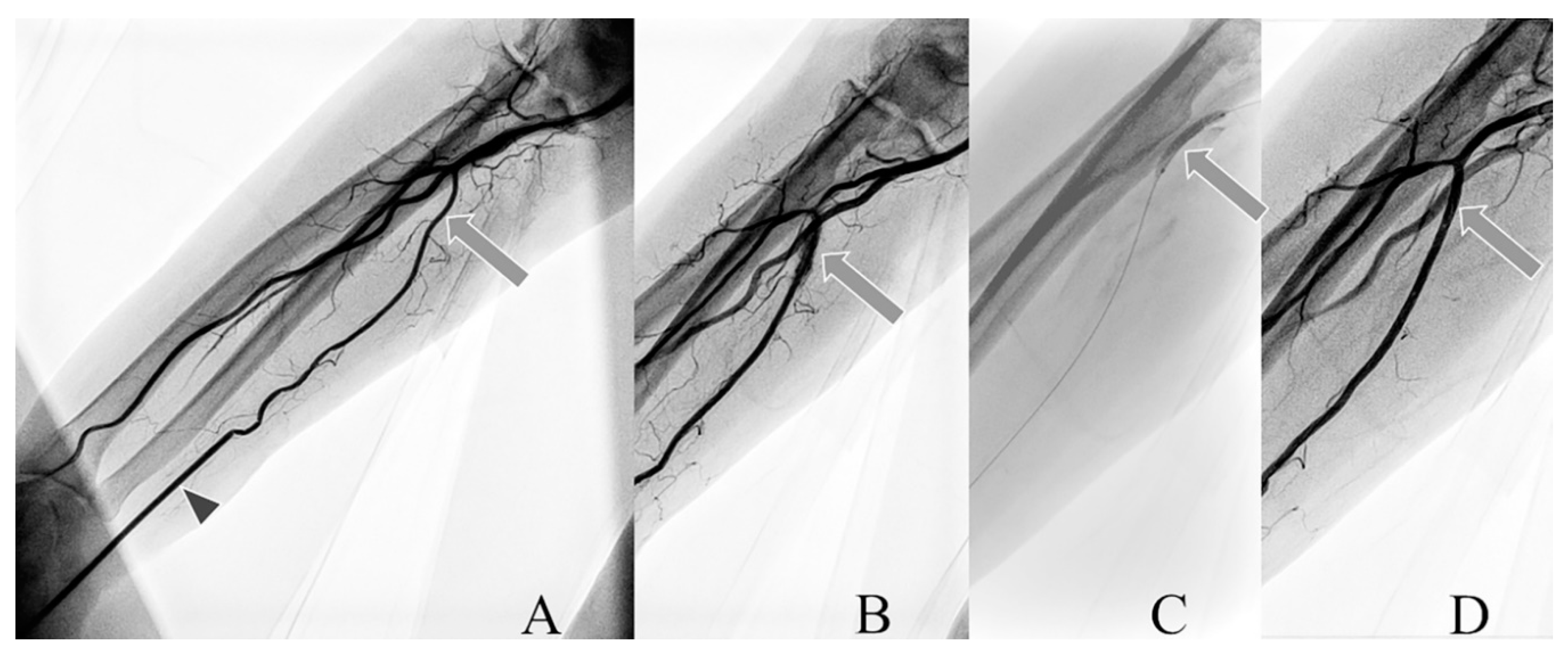 Jcm 09 03607 g003 Jcm 09 03607 g003