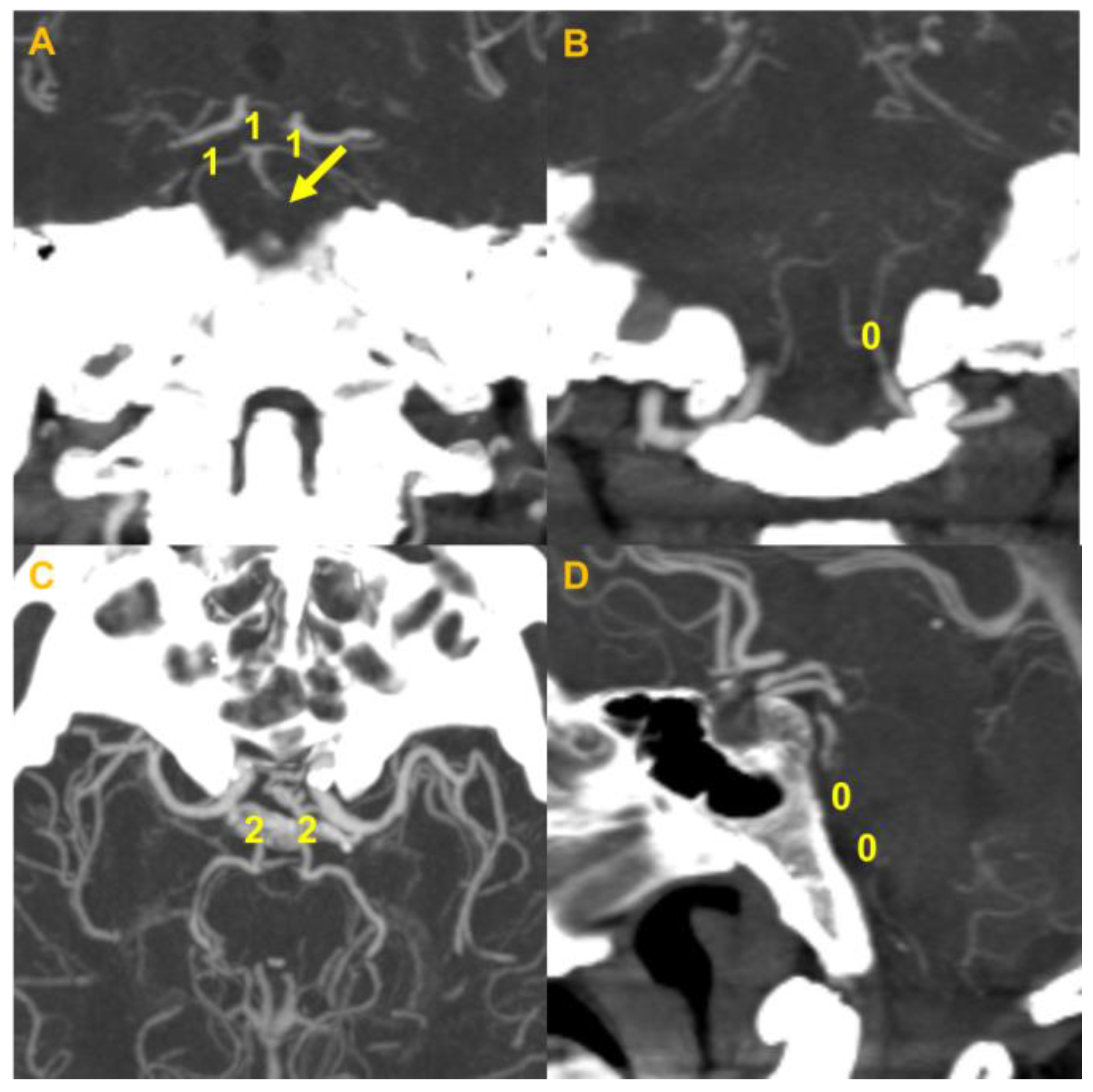 Jcm 09 03759 g003 Jcm 09 03759 g003