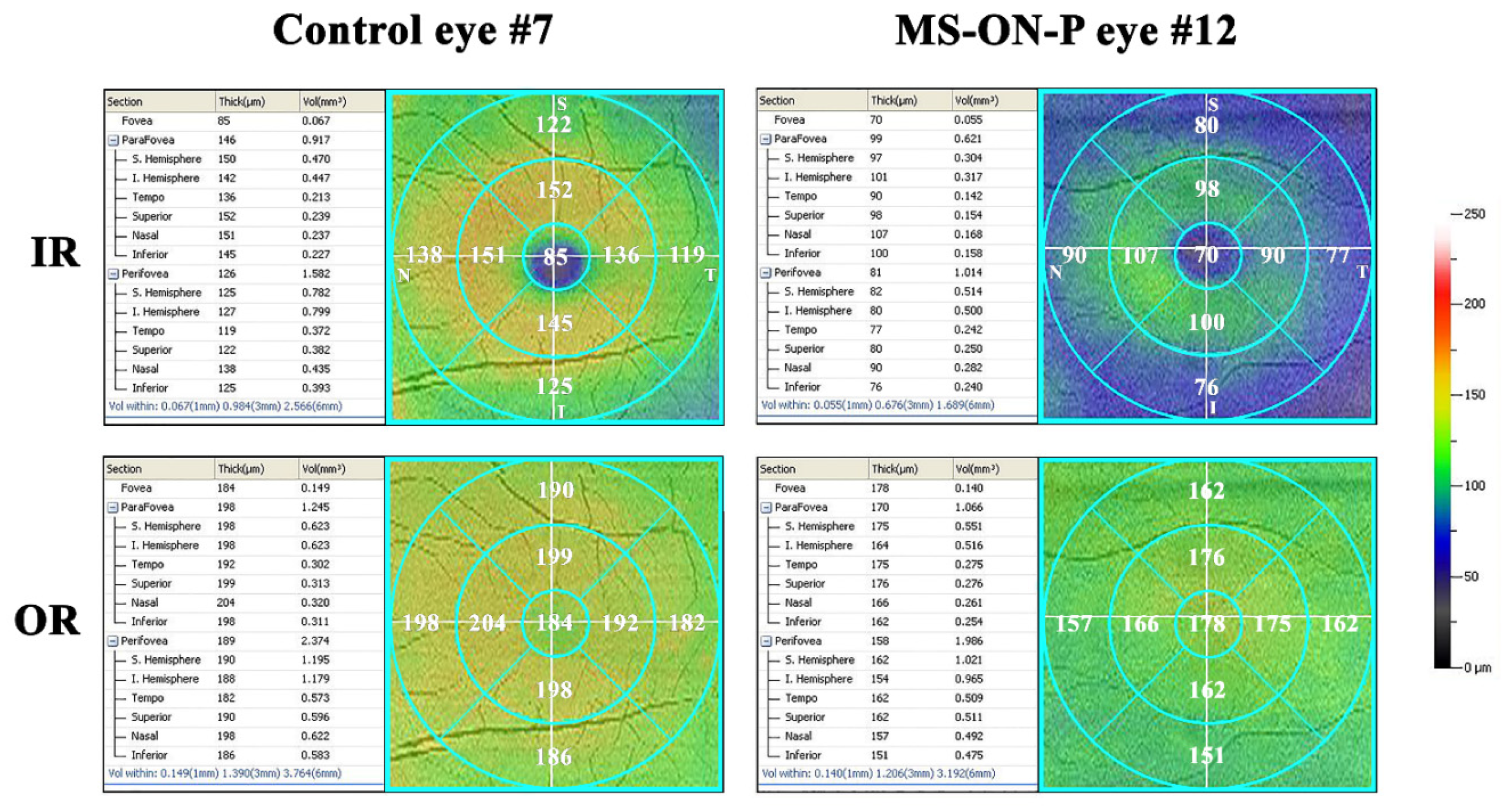 Jcm 09 03766 g004