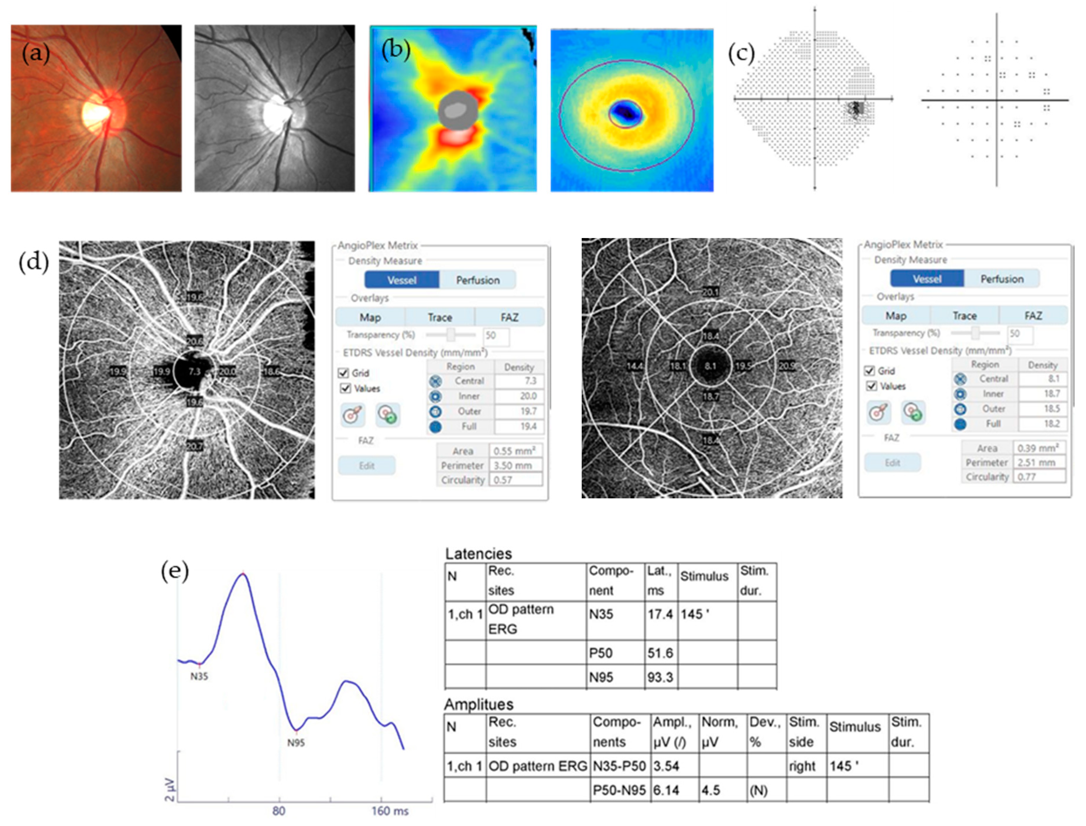Jcm 09 03854 g001 Jcm 09 03854 g001