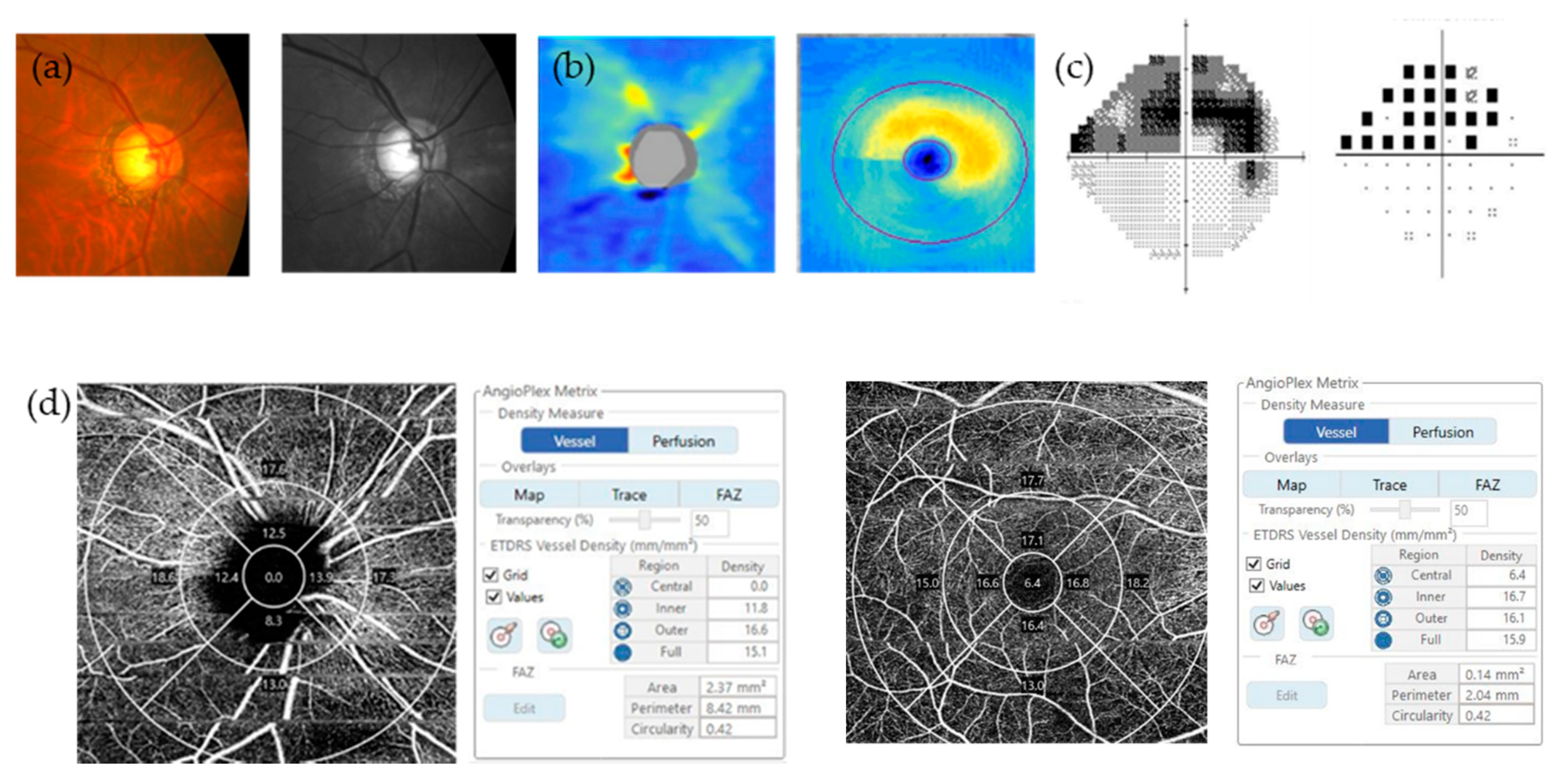 Jcm 09 03854 g002a Jcm 09 03854 g002a