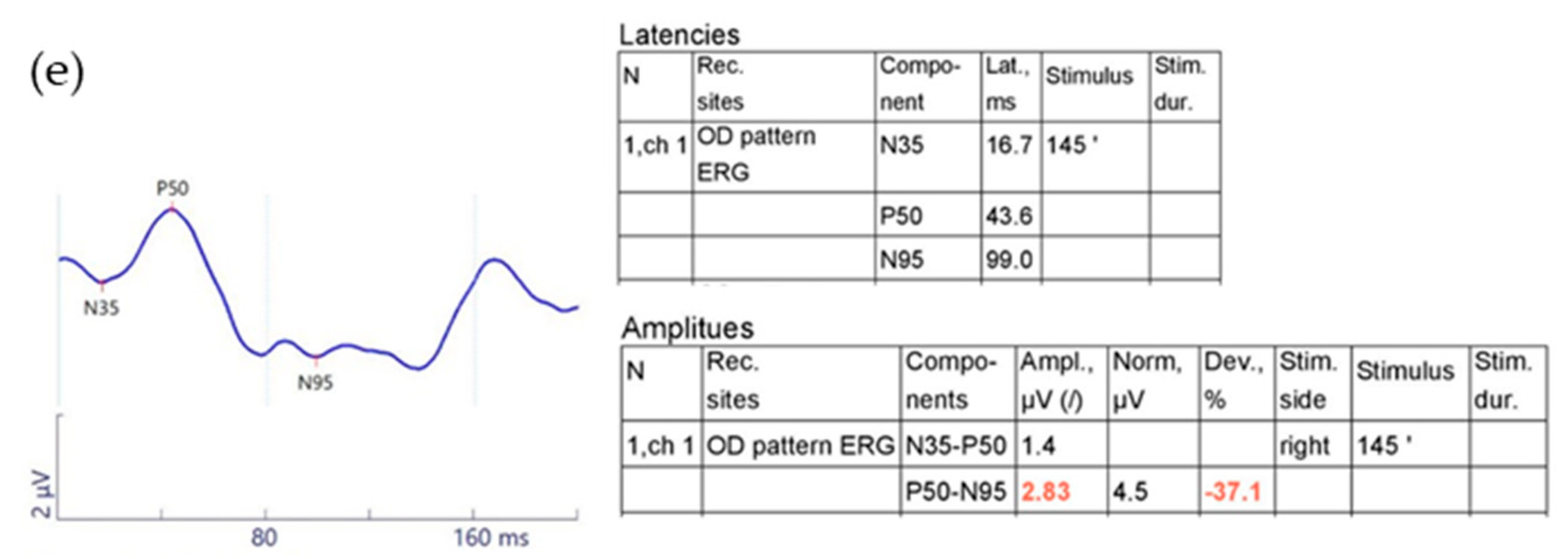 Jcm 09 03854 g002b Jcm 09 03854 g002b