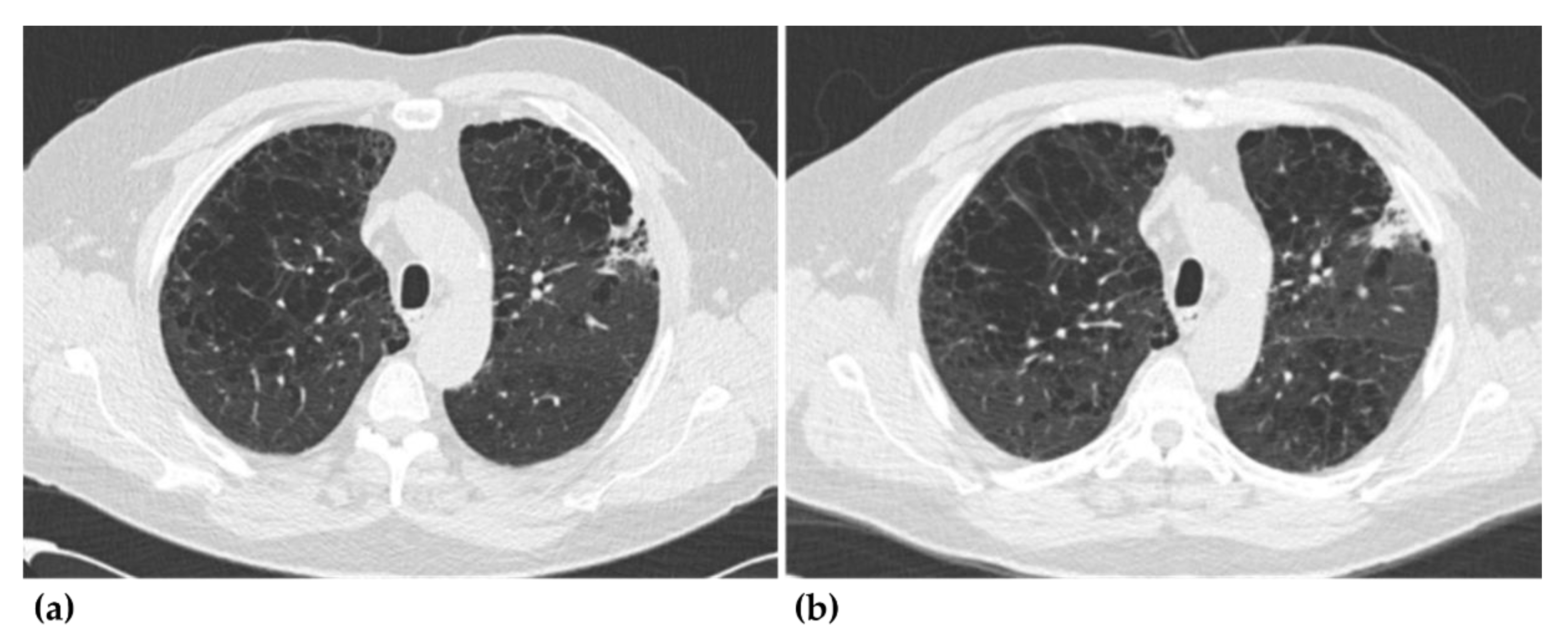 Jcm 09 03908 g003 Jcm 09 03908 g003