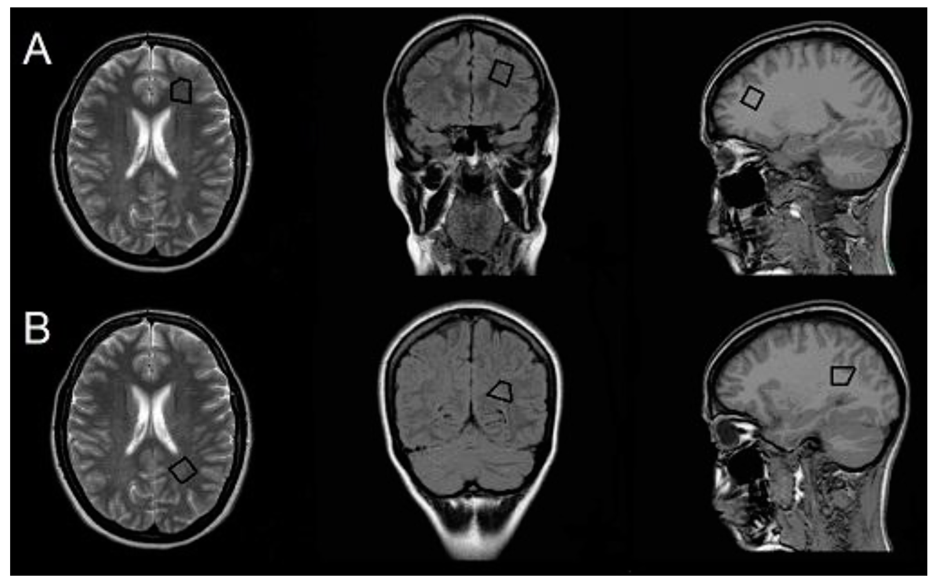 Jcm 09 03909 g001 Jcm 09 03909 g001