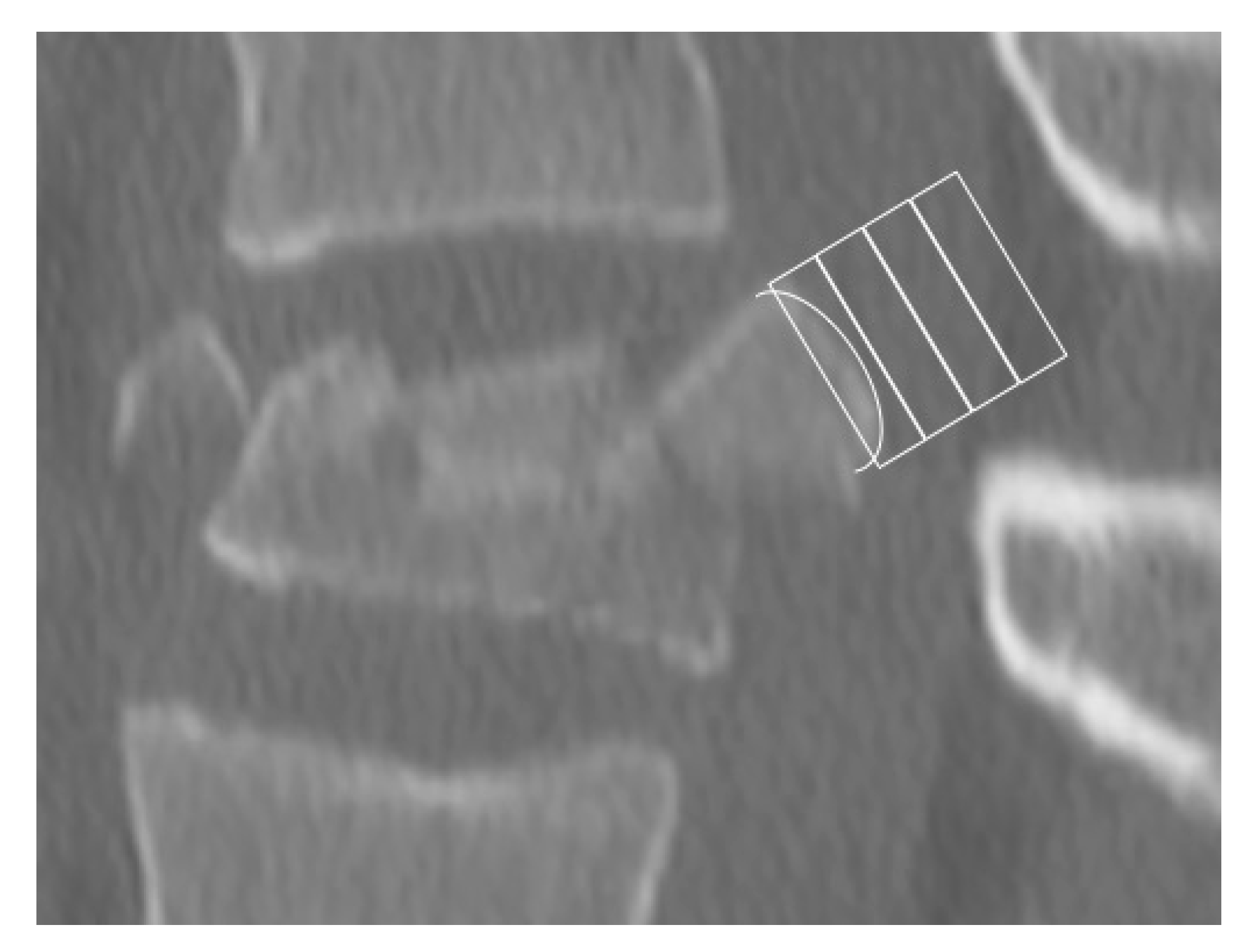 Jcm 09 03910 g003 Jcm 09 03910 g003