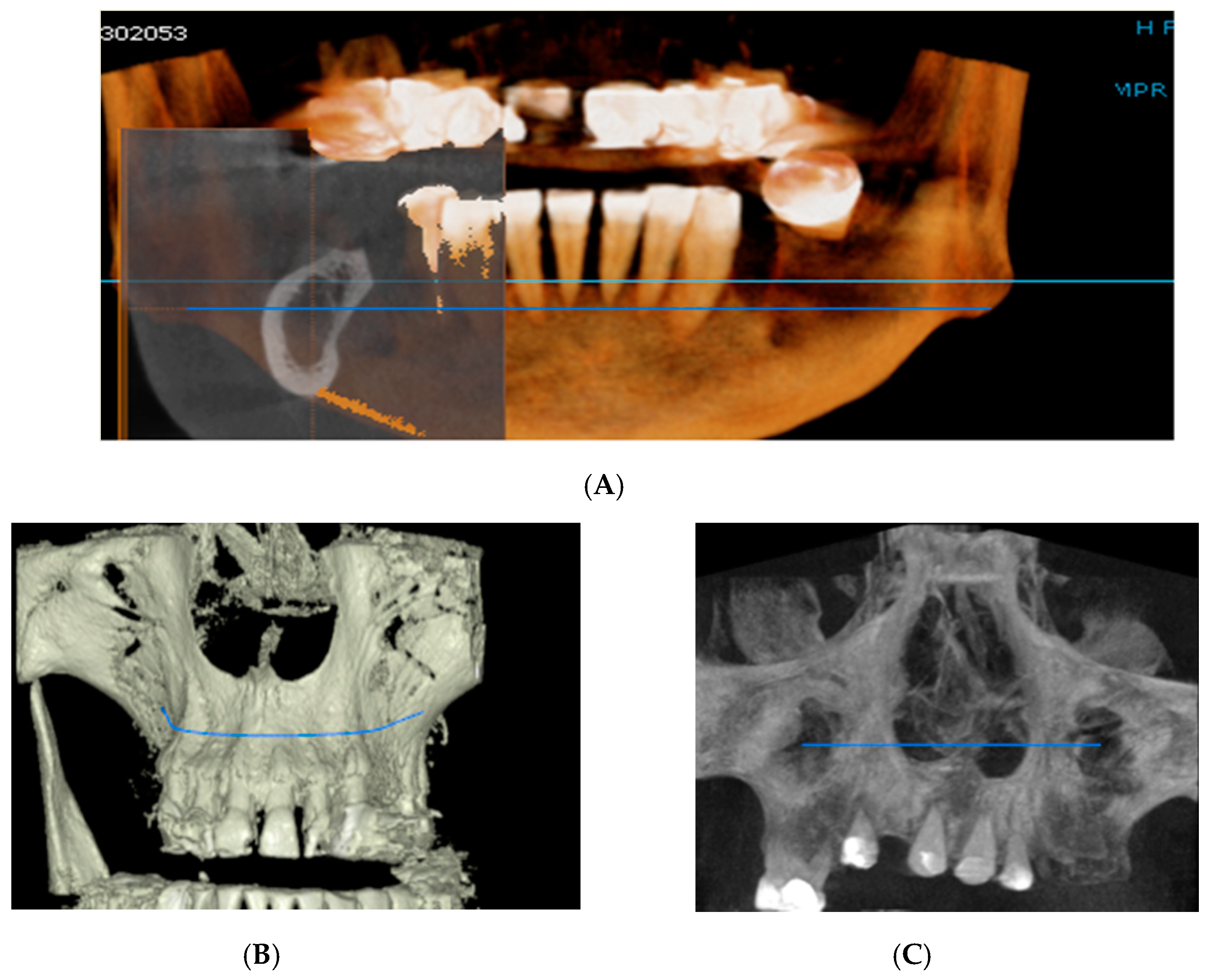 Jcm 09 03983 g002 Jcm 09 03983 g002