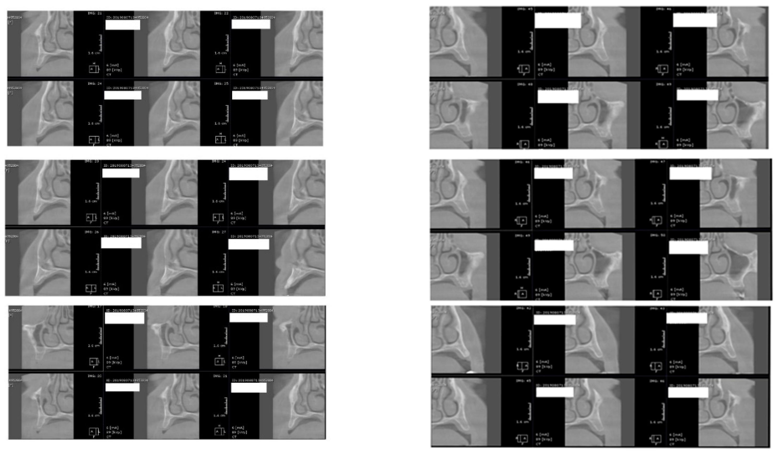 Jcm 09 03983 g003 Jcm 09 03983 g003