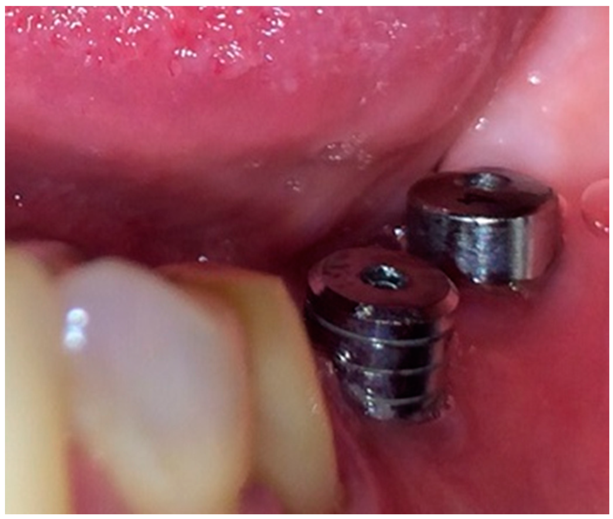 Jcm 09 03983 g006 Jcm 09 03983 g006