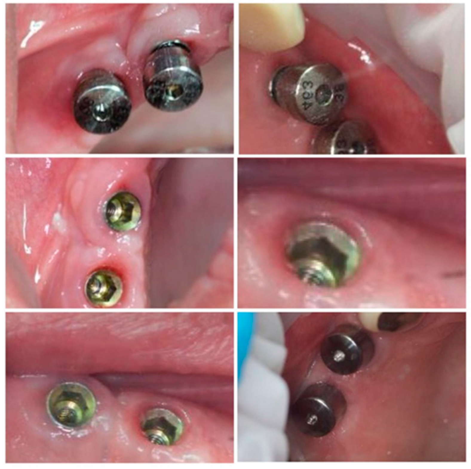 Jcm 09 03983 g008 Jcm 09 03983 g008