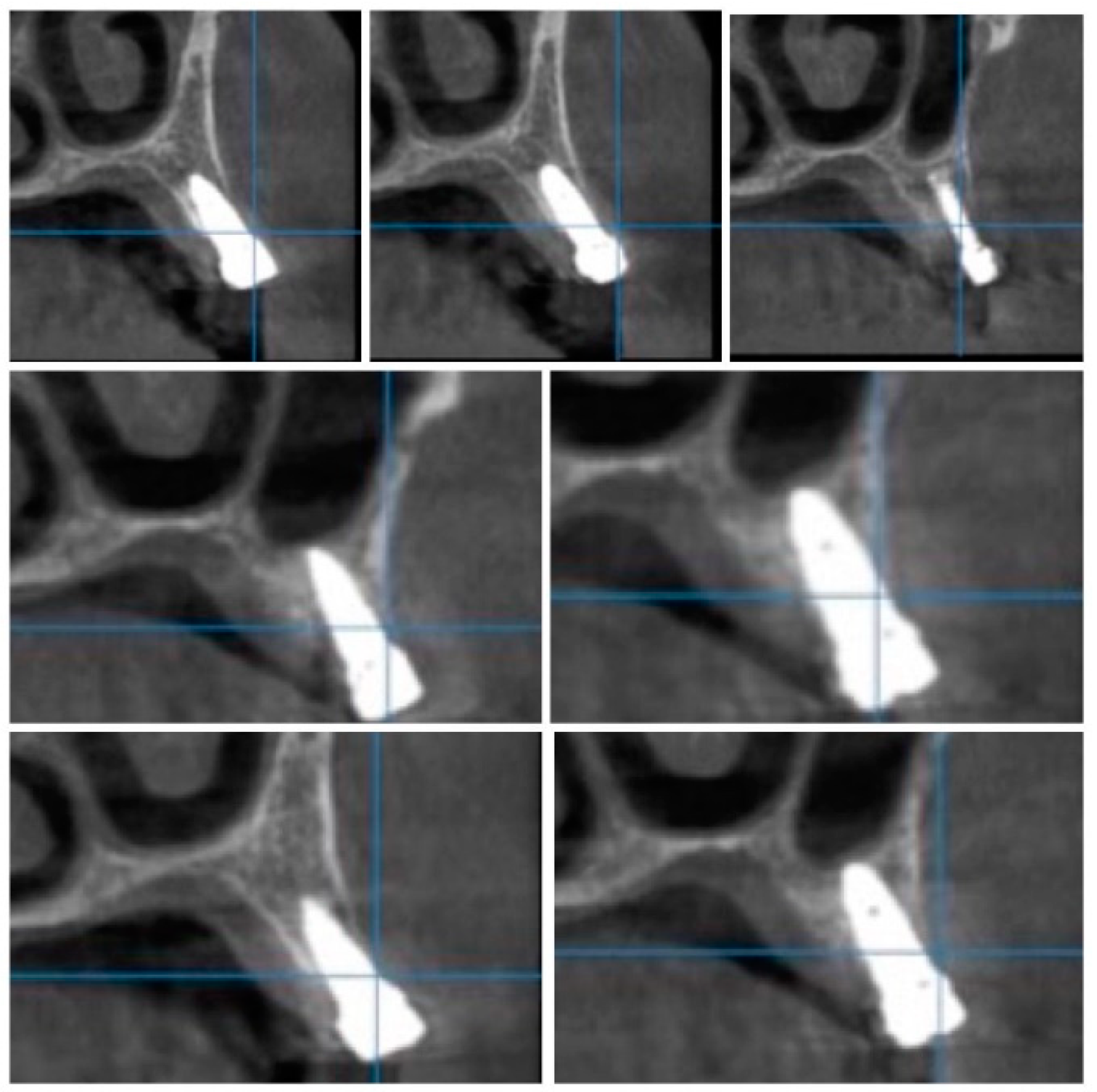 Jcm 09 03983 g011 Jcm 09 03983 g011